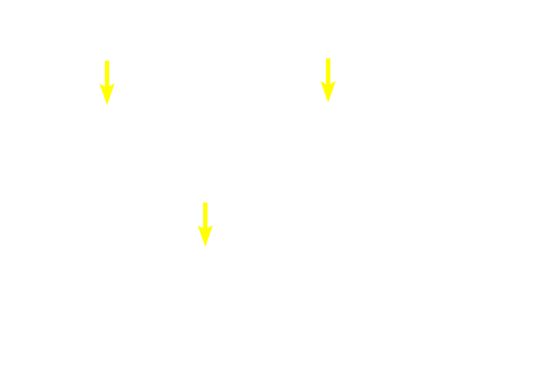  - Mitotic figures <p>After antigenic stimulation, large immunoblasts in the germinal center divide to form B lymphocytes that accumulate in the peripheral mantle.  Mitotic figures indicate this activity.  Reticular connective tissue and the reticular cells that produce them form the stroma of the nodule.  Macrophages and antigen-presenting cells are also present in the germinal center.  1000x</p>

