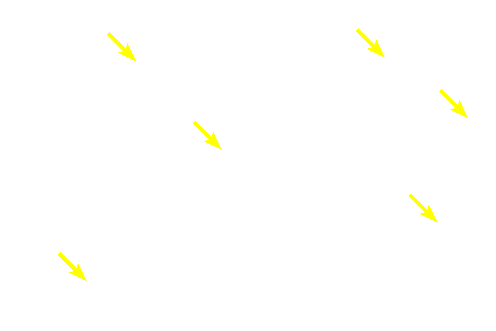 Reticular cells > <p>The stroma of the nodule is reticular connective tissue, an open meshwork of delicate reticular fibers on which are suspended the various functional cells of the nodule.  Reticular cells that produce this meshwork have nuclei that resemble those of active fibroblasts.</p>
