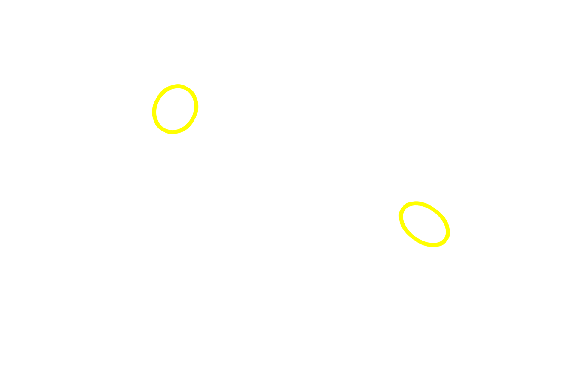 Primary nodules <p>The appendix possesses both diffuse and nodular lymphoid tissue in the lamina propria.  The presence of germinal centers differentiates secondary from primary lymphoid nodules.  All these lymphoid tissues filter tissue fluid of the lamina propria.  40x</p>
