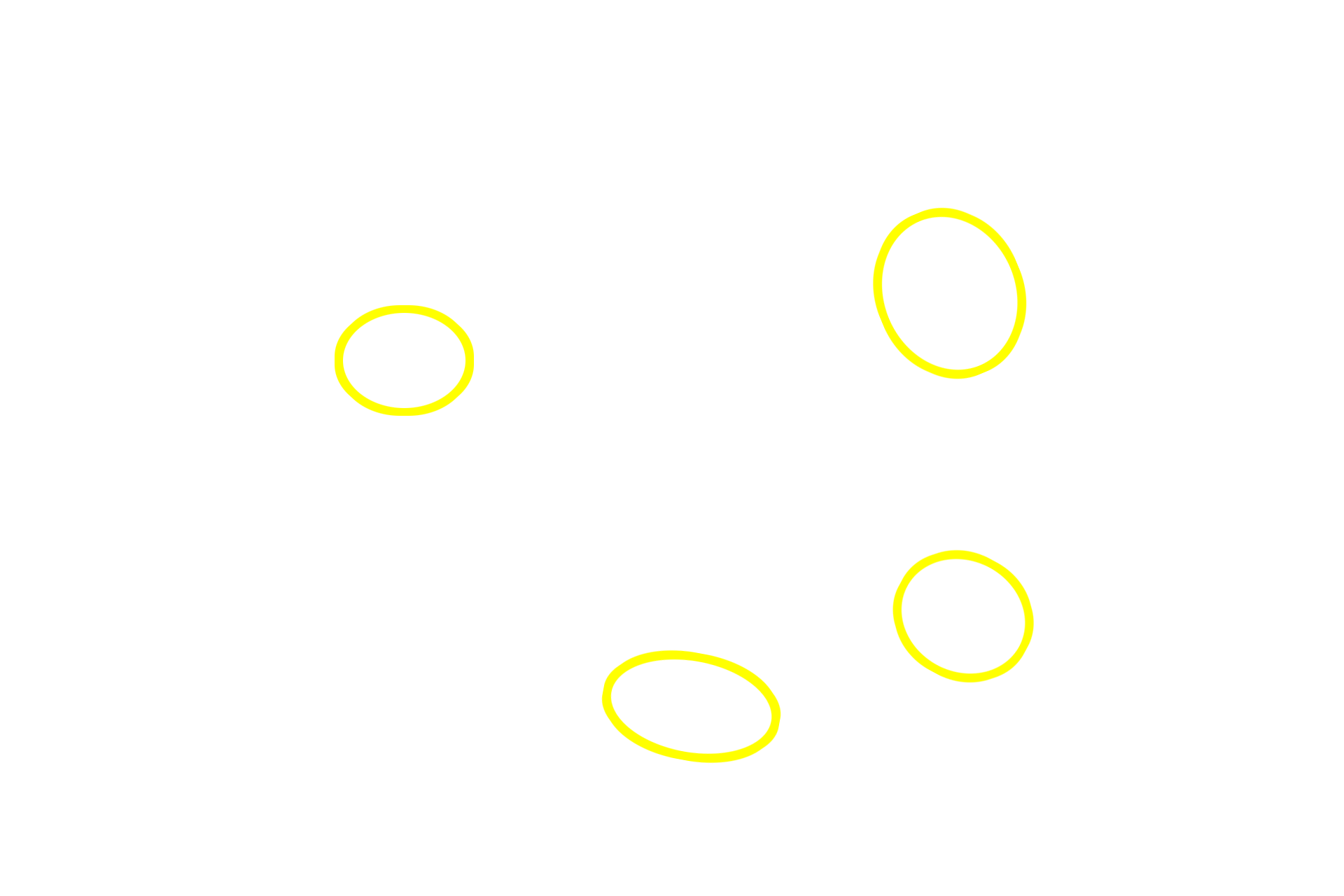 Secondary nodules <p>The appendix possesses both diffuse and nodular lymphoid tissue in the lamina propria.  The presence of germinal centers differentiates secondary from primary lymphoid nodules.  All these lymphoid tissues filter tissue fluid of the lamina propria.  40x</p>
