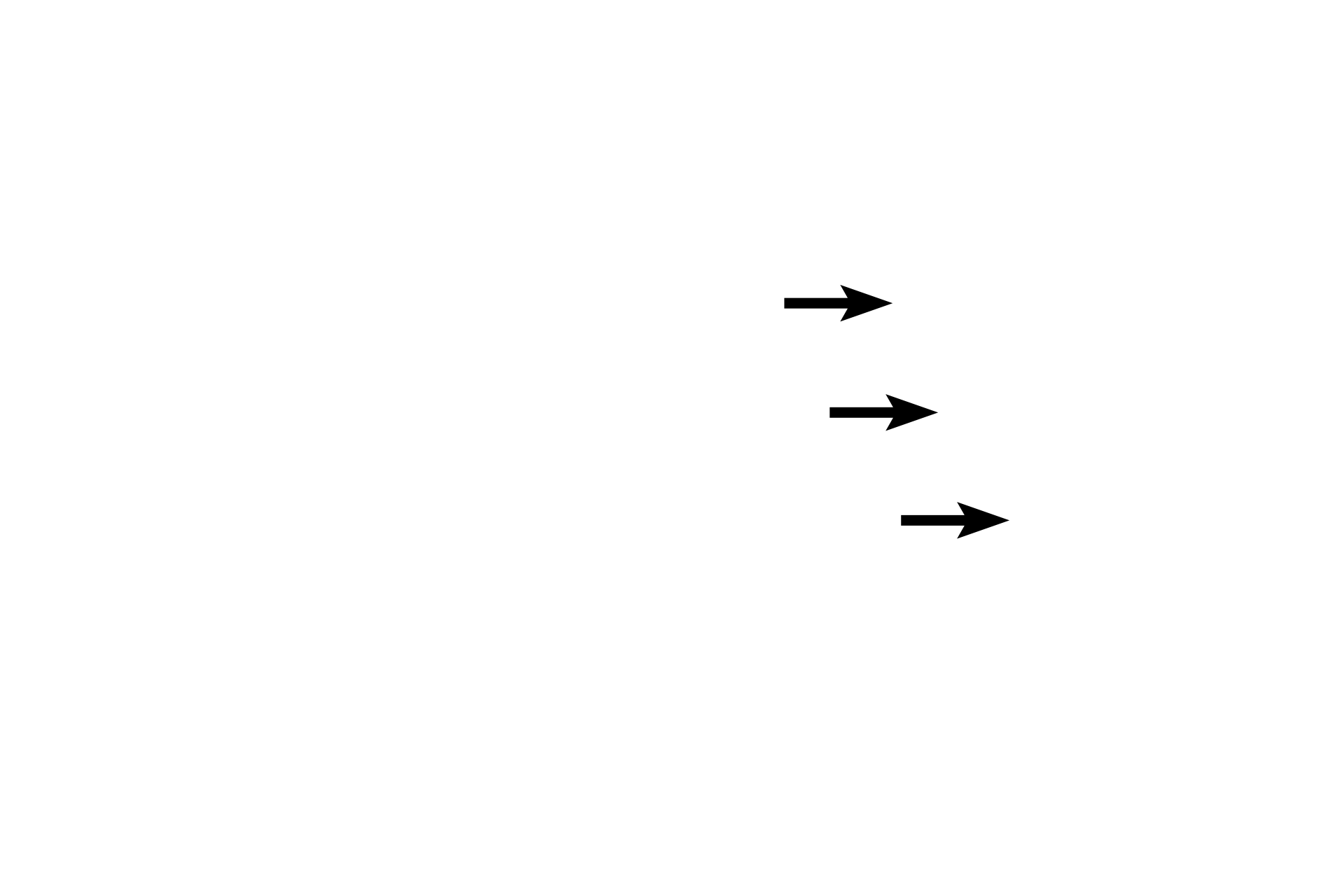 Iris <p>Additional structures in the anterior portion of the eye are also visible, including the lens, iris, cornea and pupil.</p>

