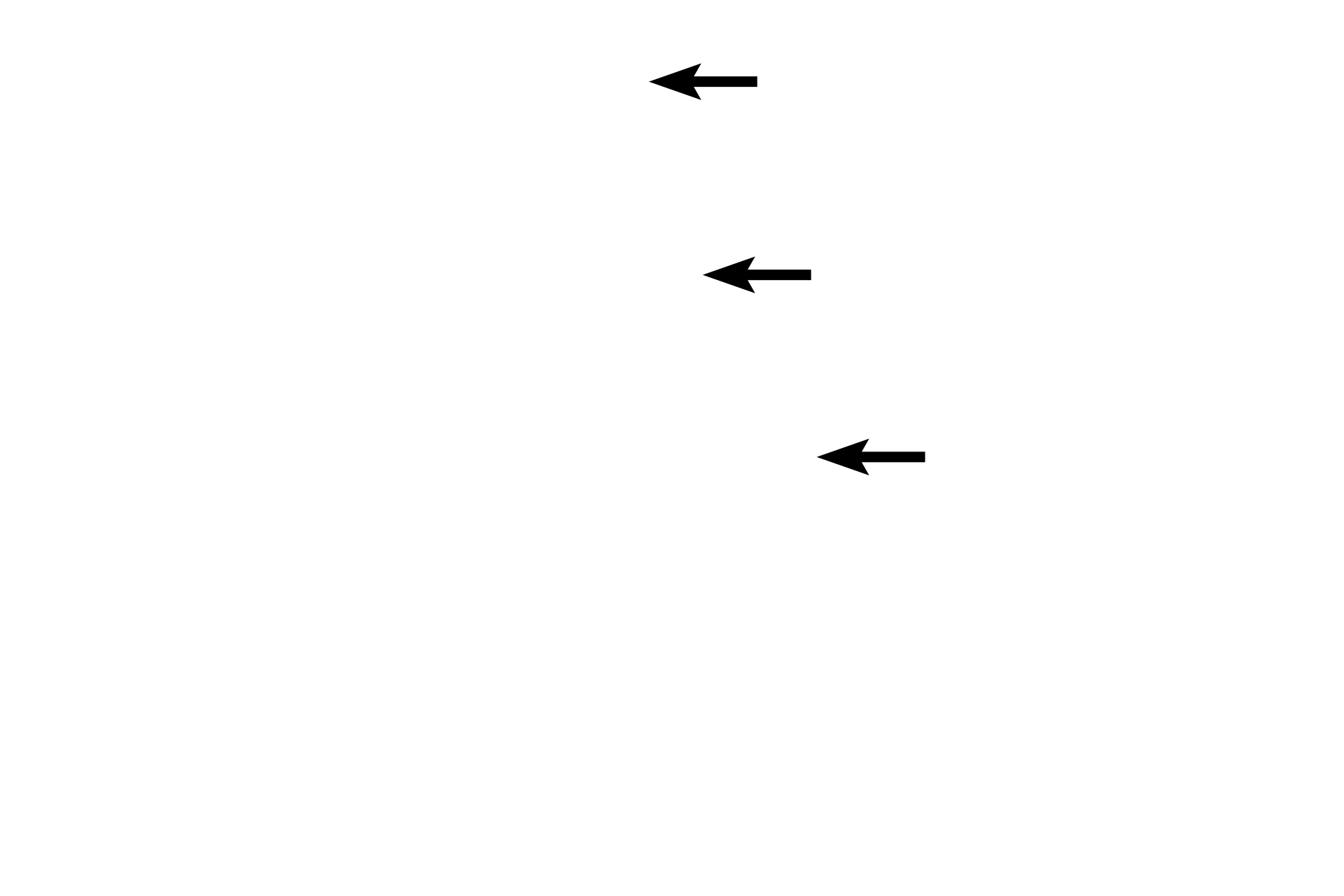 Cornea <p>Additional structures in the anterior portion of the eye are also visible, including the lens, iris, cornea and pupil.</p>
