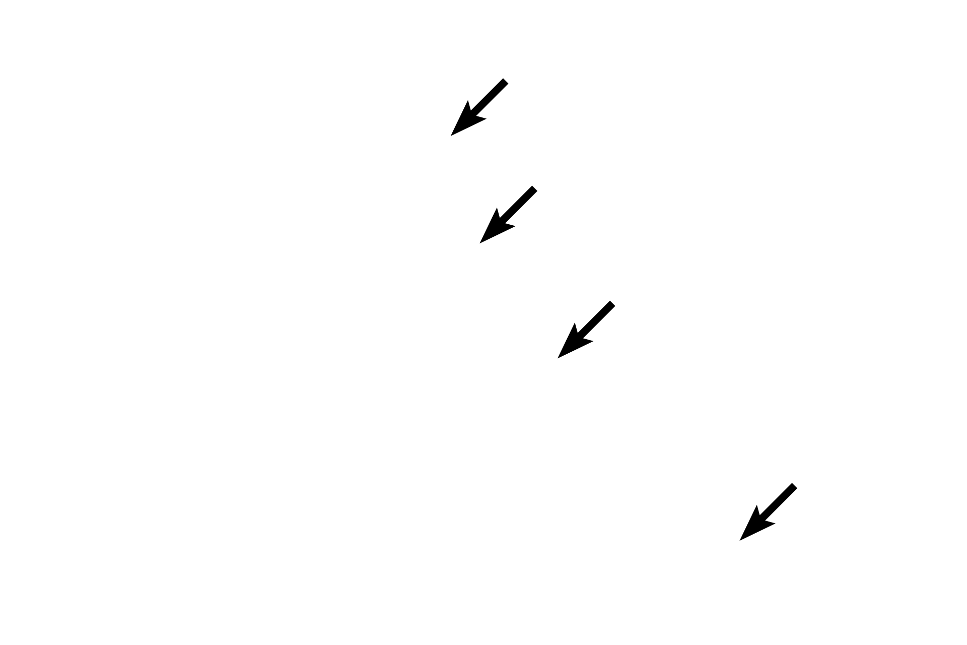 Palpebral conjunctiva > <p>The conjunctiva is a mucous membrane composed of a stratified columnar epithelium with goblet cells.  The palpebral conjunctiva covers the inner surface of the eyelid and is reflected onto the anterior surface of the sclera as bulbar conjunctiva.  The epithelium of the bulbar conjunctiva is continuous with that of the cornea.</p>

