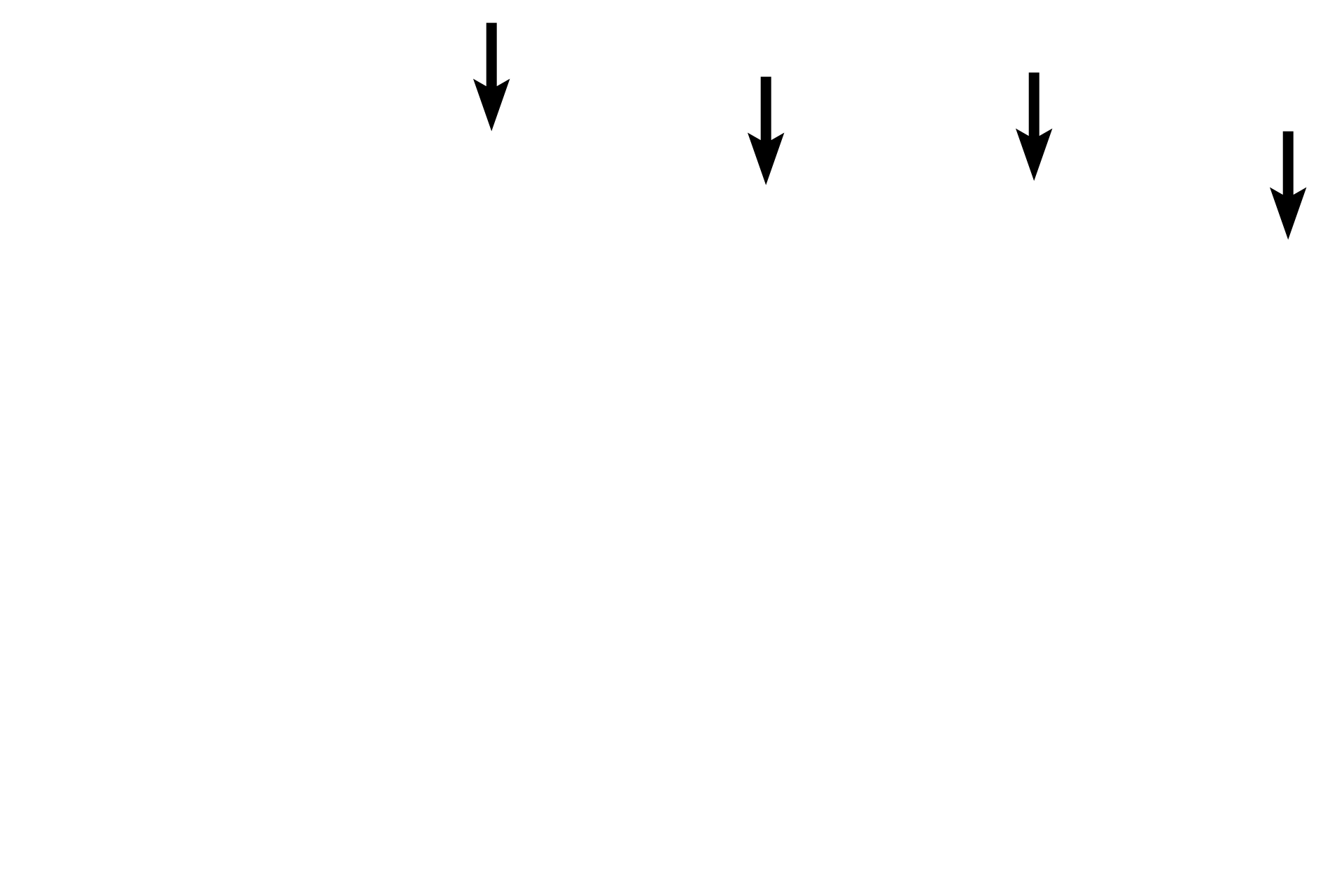 Skin <p>In this image of the eyelid the exterior surface is upwards, the eyeball is below.  The conjunctival surface shows both serous and sebum-secreting glands, the latter called Meibomium glands. Along with the lacrimal gland, they produce the tear film that bathes the eye.</p>
