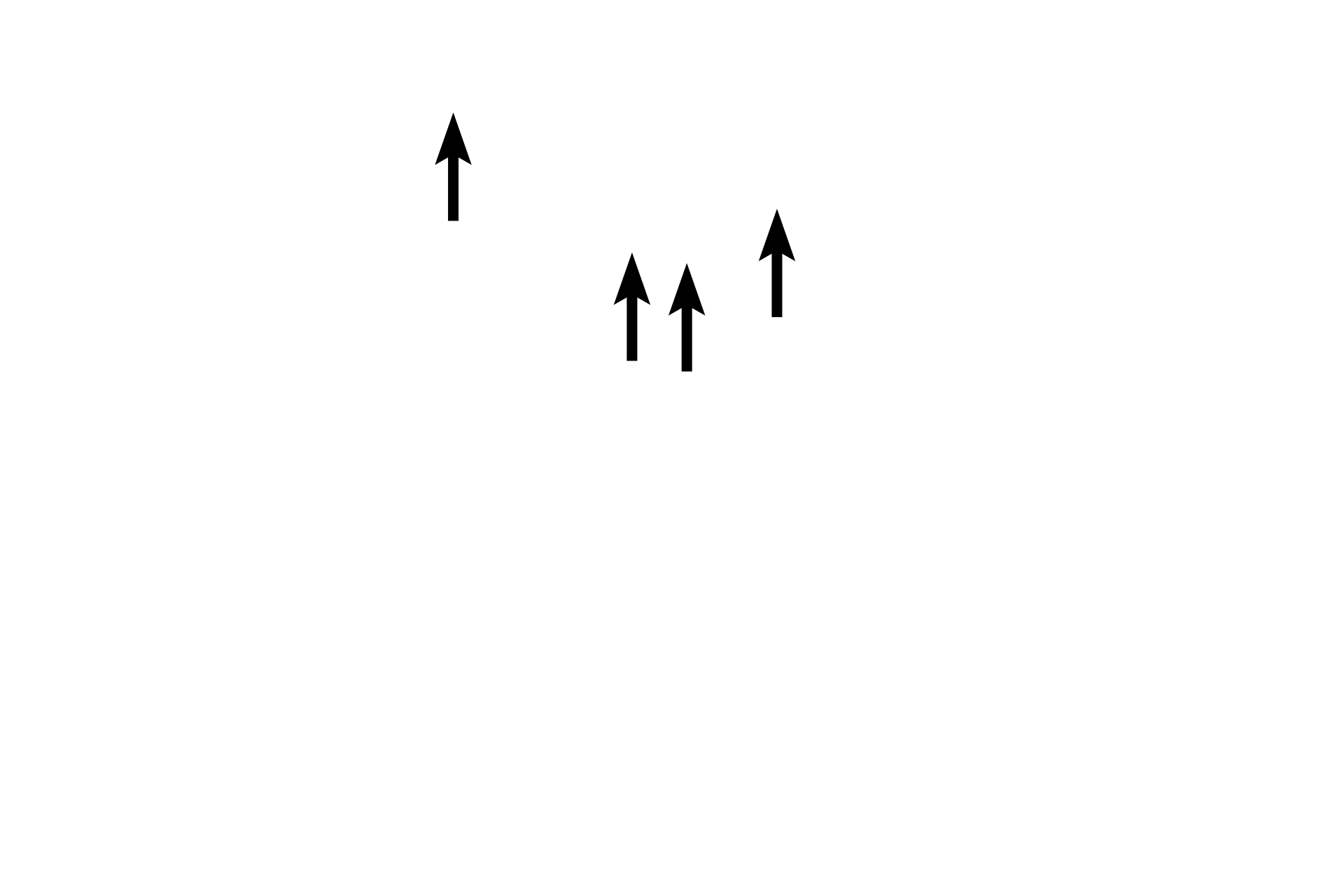 Hair follicles <p>In this image of the eyelid the exterior surface is upwards, the eyeball is below.  The conjunctival surface shows both serous and sebum-secreting glands, the latter called Meibomium glands. Along with the lacrimal gland, they produce the tear film that bathes the eye.</p>
