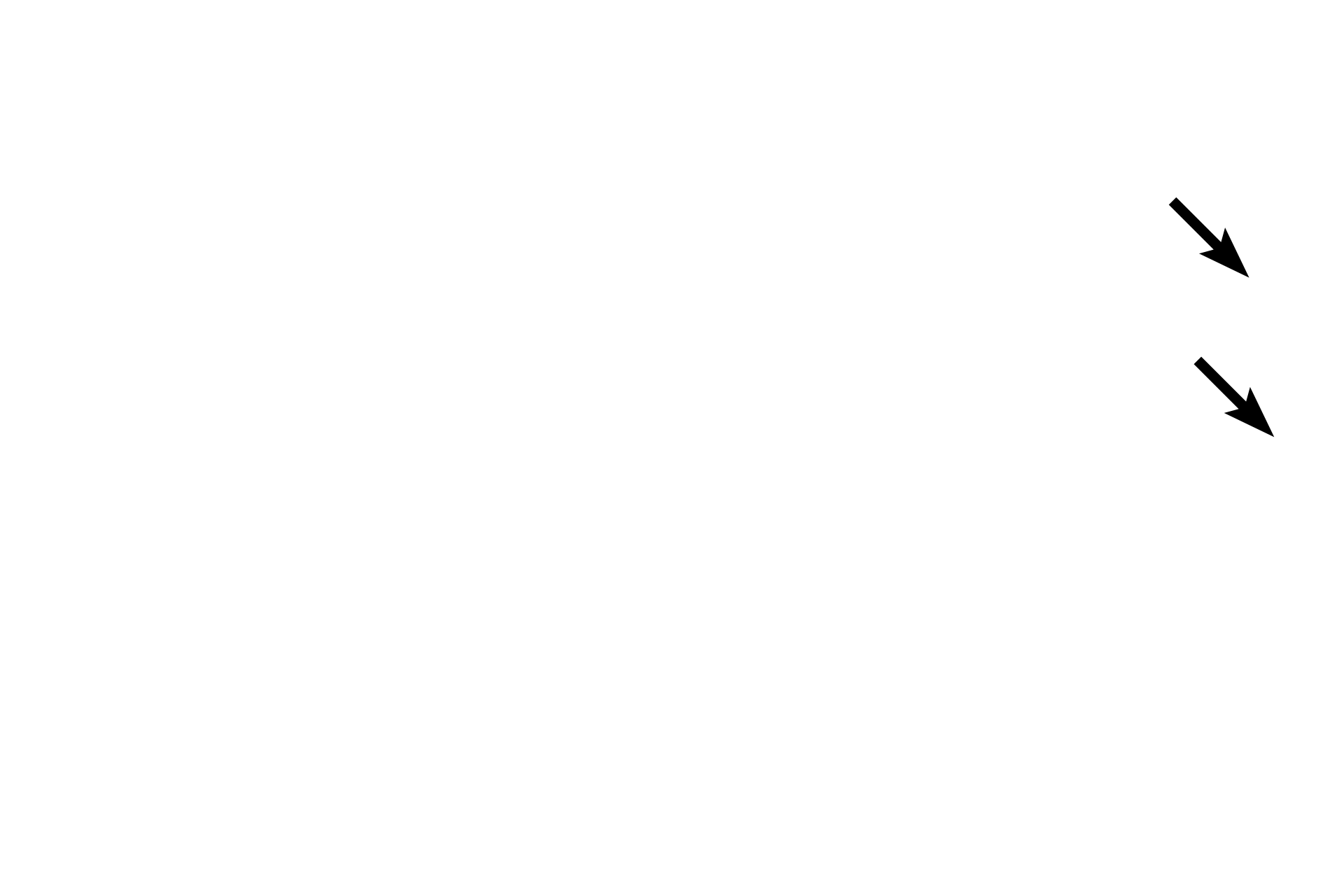 Eyelashes <p>In this image of the eyelid the exterior surface is upwards, the eyeball is below.  The conjunctival surface shows both serous and sebum-secreting glands, the latter called Meibomium glands. Along with the lacrimal gland, they produce the tear film that bathes the eye.</p>
