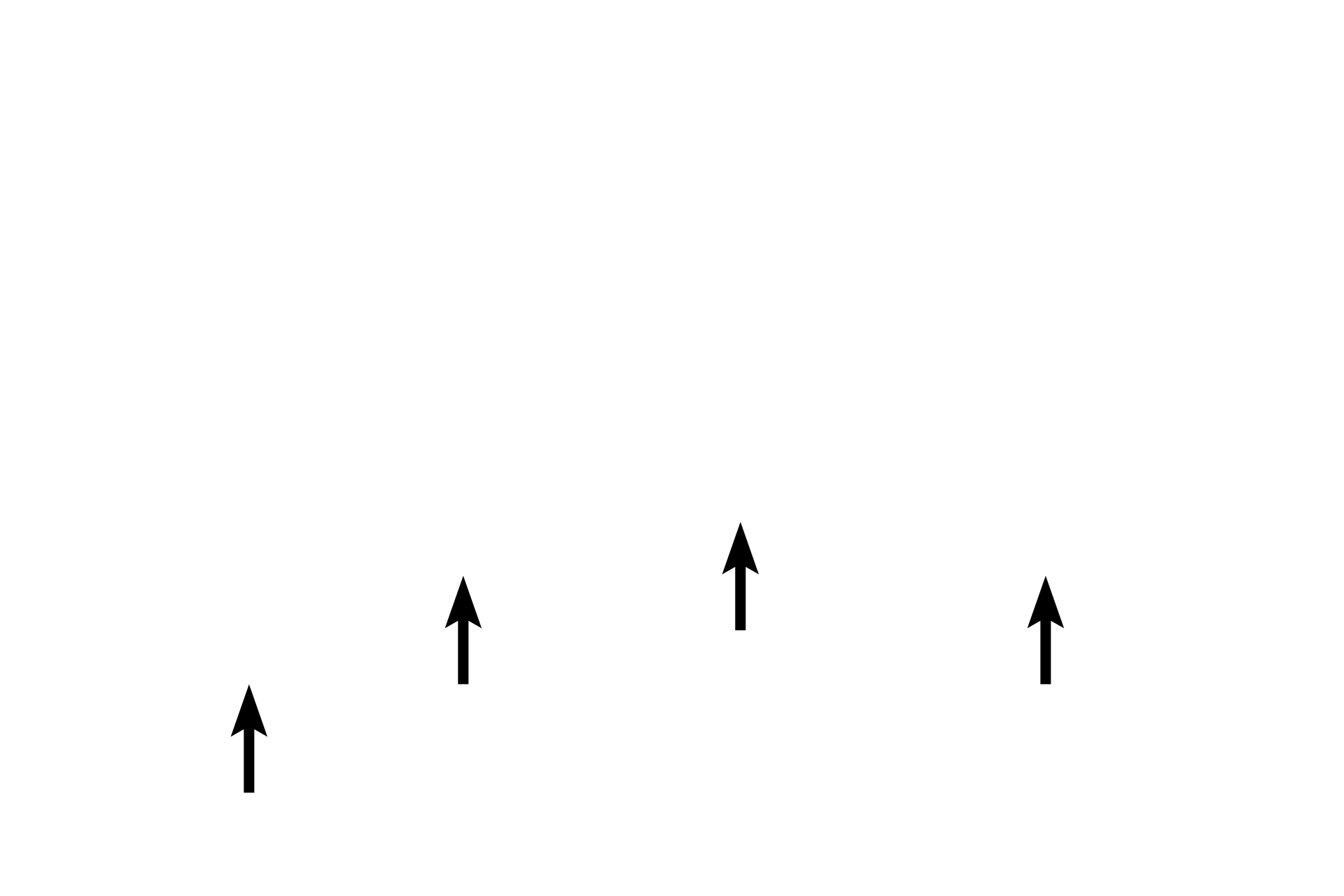 Palpebral conjunctiva <p>In this image of the eyelid the exterior surface is upwards, the eyeball is below.  The conjunctival surface shows both serous and sebum-secreting glands, the latter called Meibomium glands. Along with the lacrimal gland, they produce the tear film that bathes the eye.</p>

