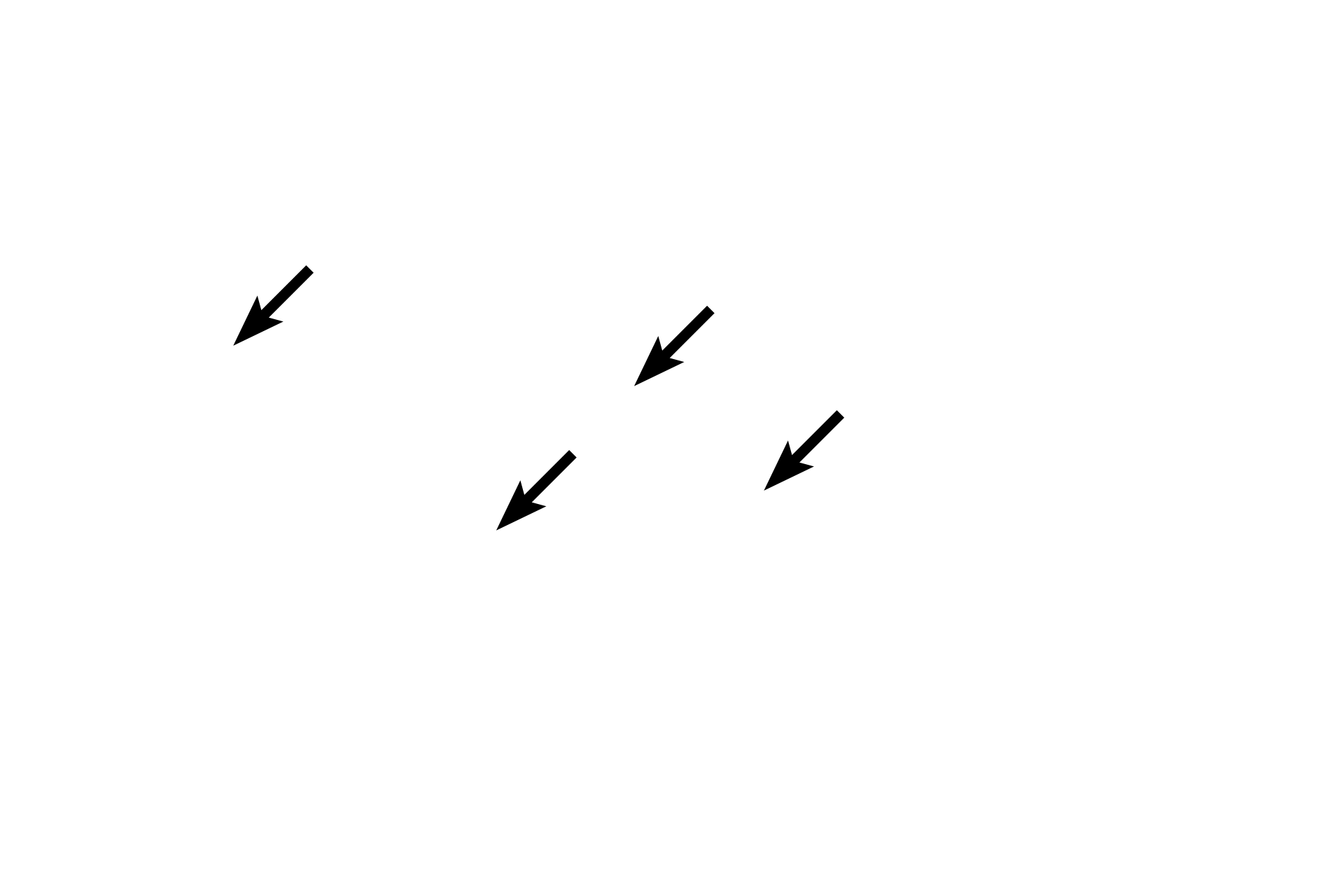 Tarsus <p>In this image of the eyelid the exterior surface is upwards, the eyeball is below.  The conjunctival surface shows both serous and sebum-secreting glands, the latter called Meibomium glands. Along with the lacrimal gland, they produce the tear film that bathes the eye.</p>
