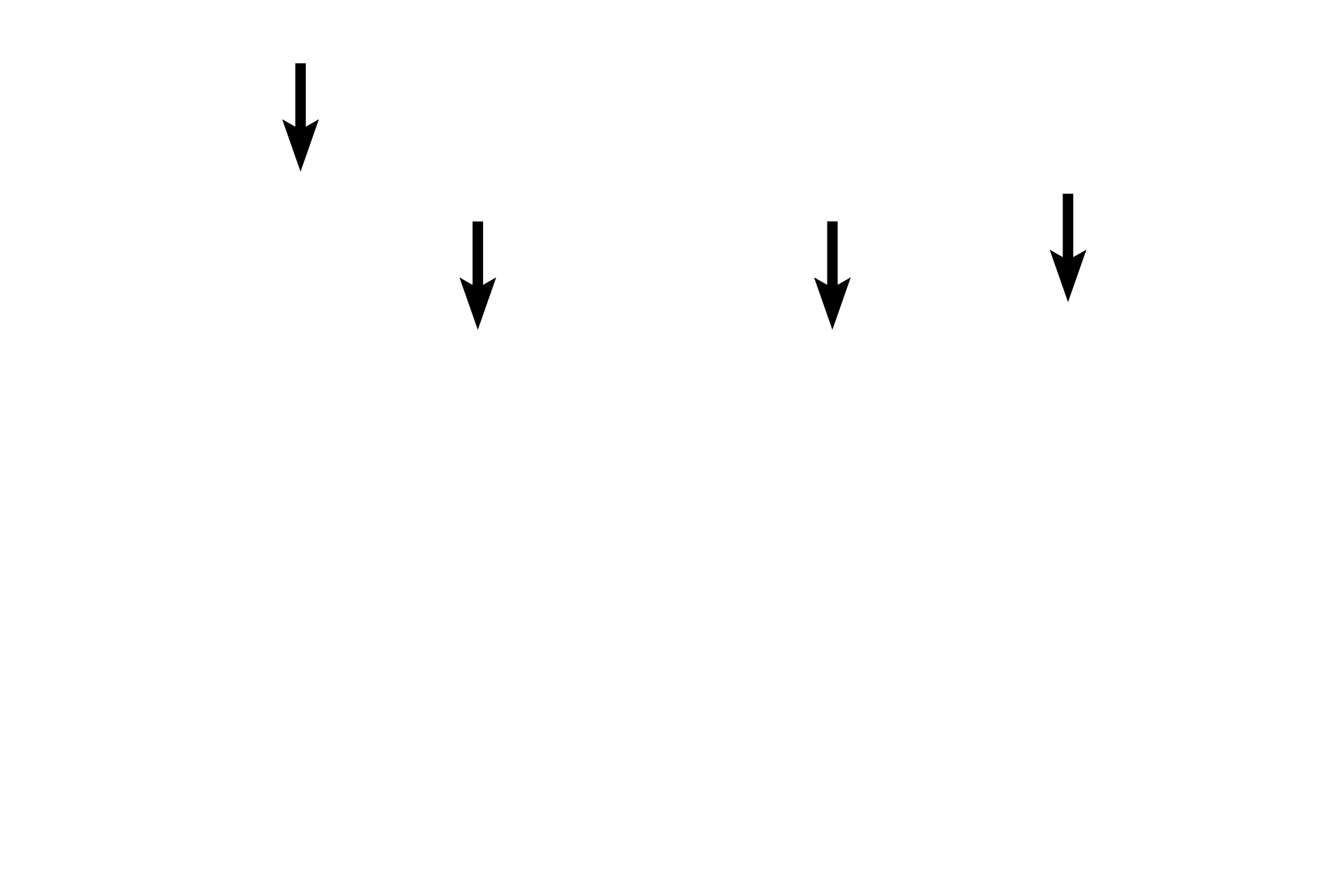 Orbicularis oculi muscle <p>In this image of the eyelid the exterior surface is upwards, the eyeball is below.  The conjunctival surface shows both serous and sebum-secreting glands, the latter called Meibomium glands. Along with the lacrimal gland, they produce the tear film that bathes the eye.</p>

