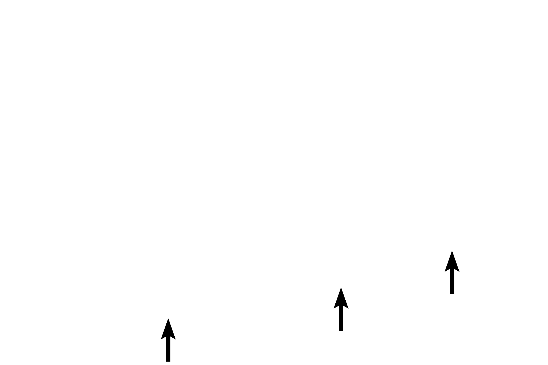 Palpebral conjunctiva <p>This higher magnification image of a Meibomium gland (tarsal gland) shows its simple, branched acinar structure.  Each acinus empties into an unbranched duct that opens at the margin of the eyelid.  There are numerous Meibomium glands in each eyelid, with a larger number in the upper eyelid.  Meibomian glands secrete an oily material by the holocrine mode of secretion.</p>
