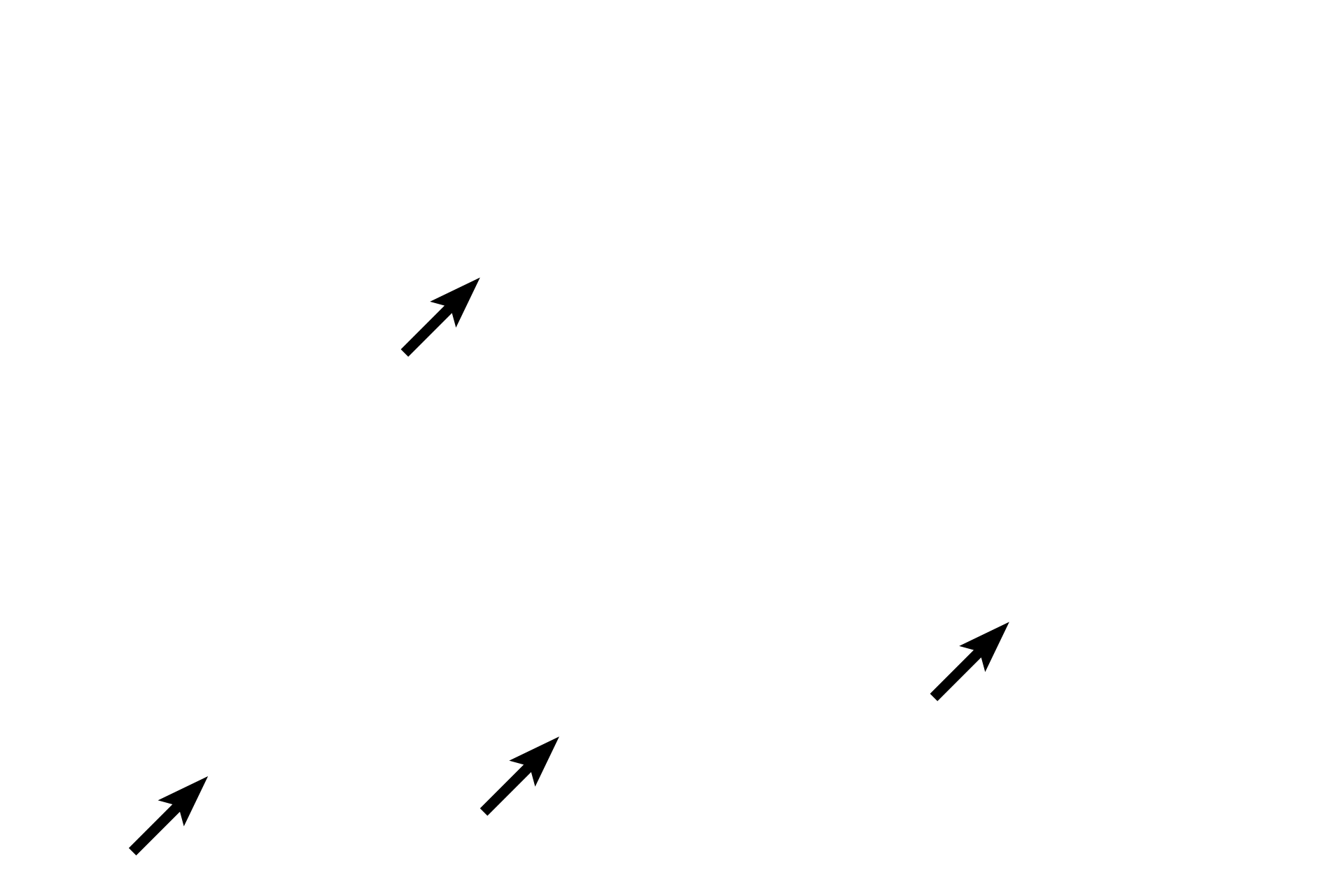 Tarsus <p>This higher magnification image of a Meibomium gland (tarsal gland) shows its simple, branched acinar structure.  Each acinus empties into an unbranched duct that opens at the margin of the eyelid.  There are numerous Meibomium glands in each eyelid, with a larger number in the upper eyelid.  Meibomian glands secrete an oily material by the holocrine mode of secretion.</p>
