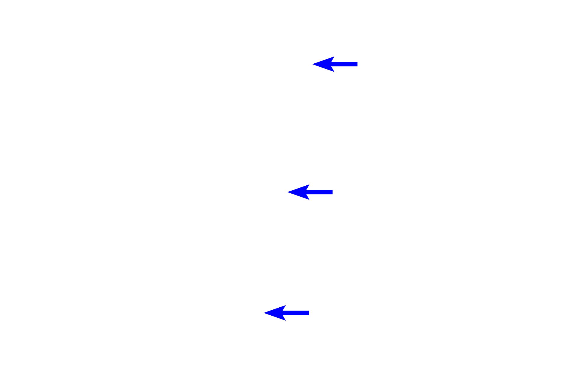  - Lens epithelium <p>The anterior surface of the lens and portion of the iris are shown here.  The outermost layer of the lens is a capsule, which represents the highly thickened basal lamina of the lens epithelium lying inside the capsule.  This capsule consists primarily of proteoglycans and type IV collagen and except in the equatorial regions, is thicker on the anterior, than on the posterior, surface of the lens.</p>
