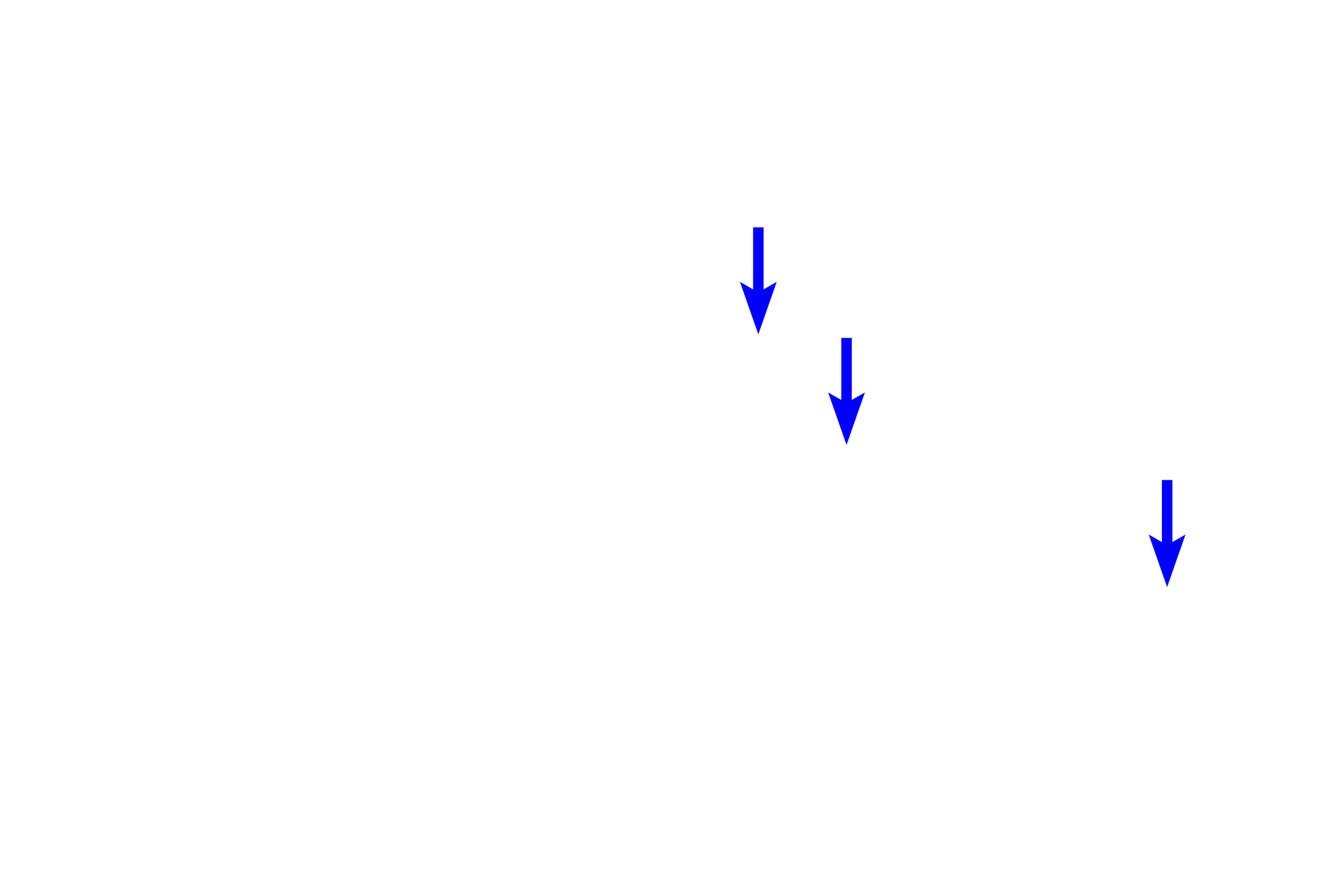  - Lens fibers <p>The anterior surface of the lens and portion of the iris are shown here.  The outermost layer of the lens is a capsule, which represents the highly thickened basal lamina of the lens epithelium lying inside the capsule.  This capsule consists primarily of proteoglycans and type IV collagen and except in the equatorial regions, is thicker on the anterior, than on the posterior, surface of the lens.</p>
