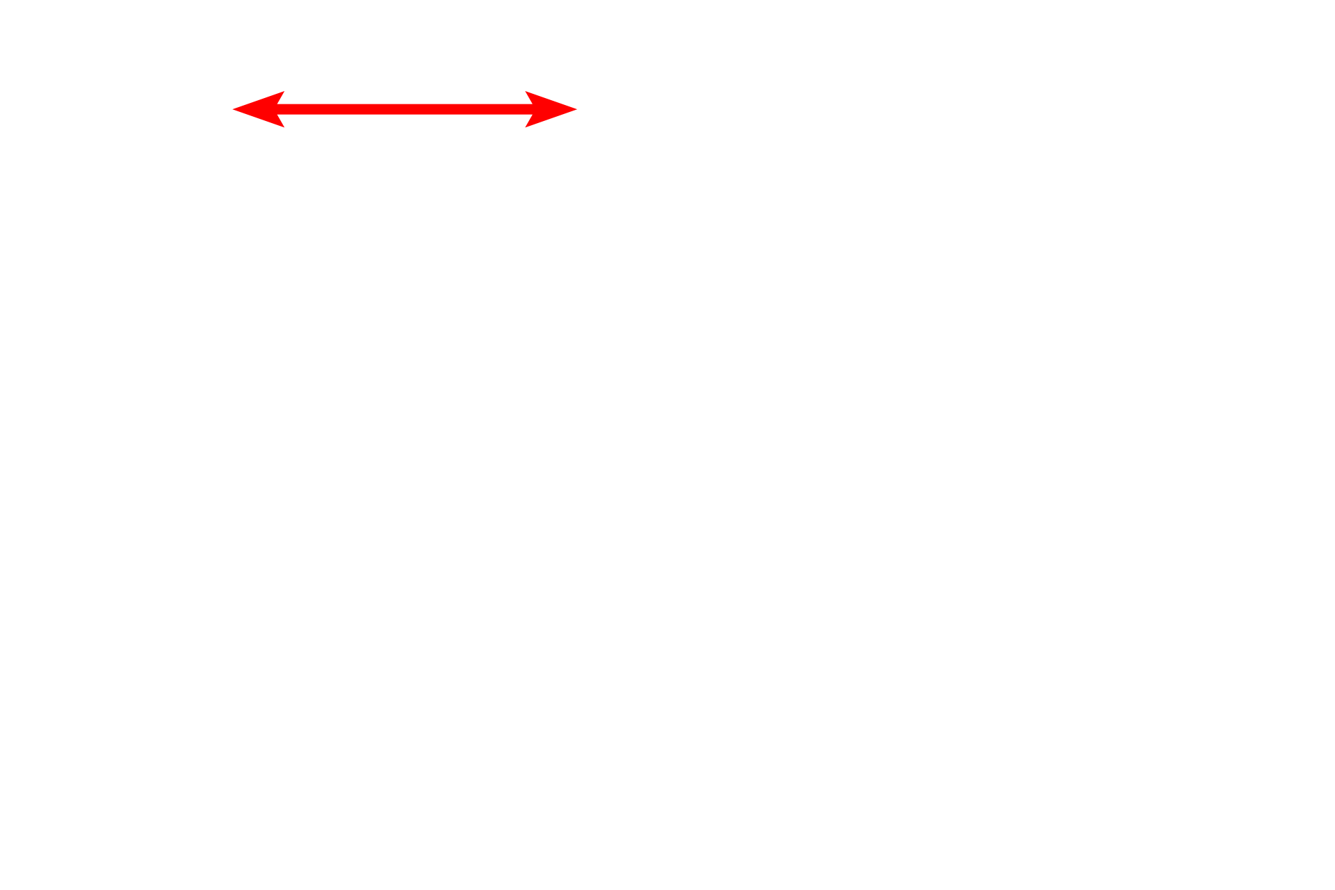 Iris <p>The anterior surface of the lens and portion of the iris are shown here.  The outermost layer of the lens is a capsule, which represents the highly thickened basal lamina of the lens epithelium lying inside the capsule.  This capsule consists primarily of proteoglycans and type IV collagen and except in the equatorial regions, is thicker on the anterior, than on the posterior, surface of the lens.</p>

