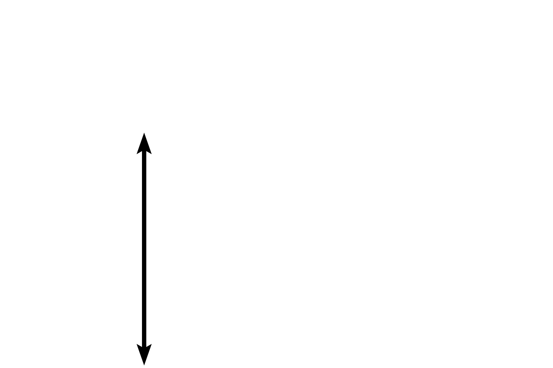 Pupil <p>This image shows the anterior surface of the lens and portion of the iris.  The outermost layer of the lens is a capsule, which represents the highly thickened basal lamina of the lens epithelium that lies inside the capsule.  This capsule consists primarily of proteoglycans and type IV collagen and except in the equatorial regions, is thicker on the anterior, than on the posterior, surface of the lens.</p>
