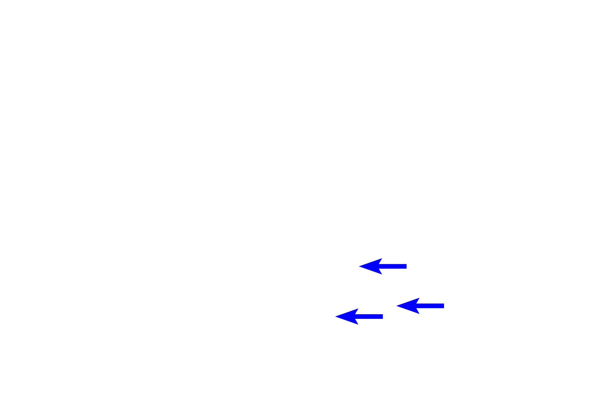 Zonular fibers > <p>Zonular fibers are delicate microfibrils, which arise from the basal lamina of the ciliary epithelium and attach to the lens capsule.  Contraction of the ciliary body muscle alters the tension on these fibers and, thus, affects the shape of the lens.</p>
