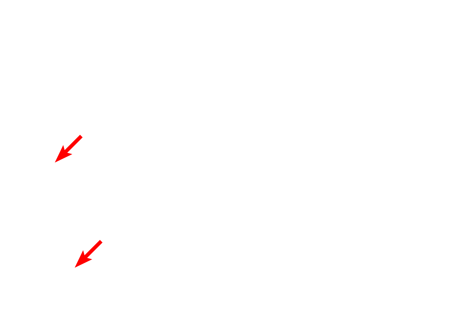 Posterior iris epithelium <p>The ciliary epithelium is a portion of the non-sensory retinal layer of the inner tunic.  This layer lines the posterior surface of the ciliary body and its processes, before continuing over the posterior surface of the iris.  Ciliary epithelium consists of two epithelial layers, with the one adjacent to the stroma being heavily pigmented.  The ciliary epithelium produces the zonule fibers and secretes aqueous humor.</p>
