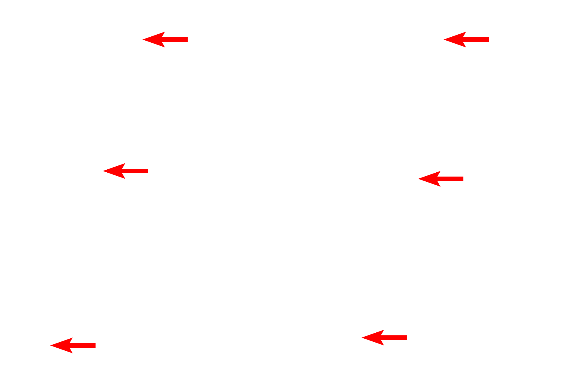  - Iris epithelium > <p>The epithelium covering the posterior surface is a continuation of the non-sensory retina and consists of two layers:  a heavily pigmented epithelium next to the posterior chamber and a less pigmented layer of myoepithelial cells from which radially arranged processes extend into the stroma, forming dilator pupillae muscle.  Contraction of this muscle results in an increase in pupillary diameter.</p>
