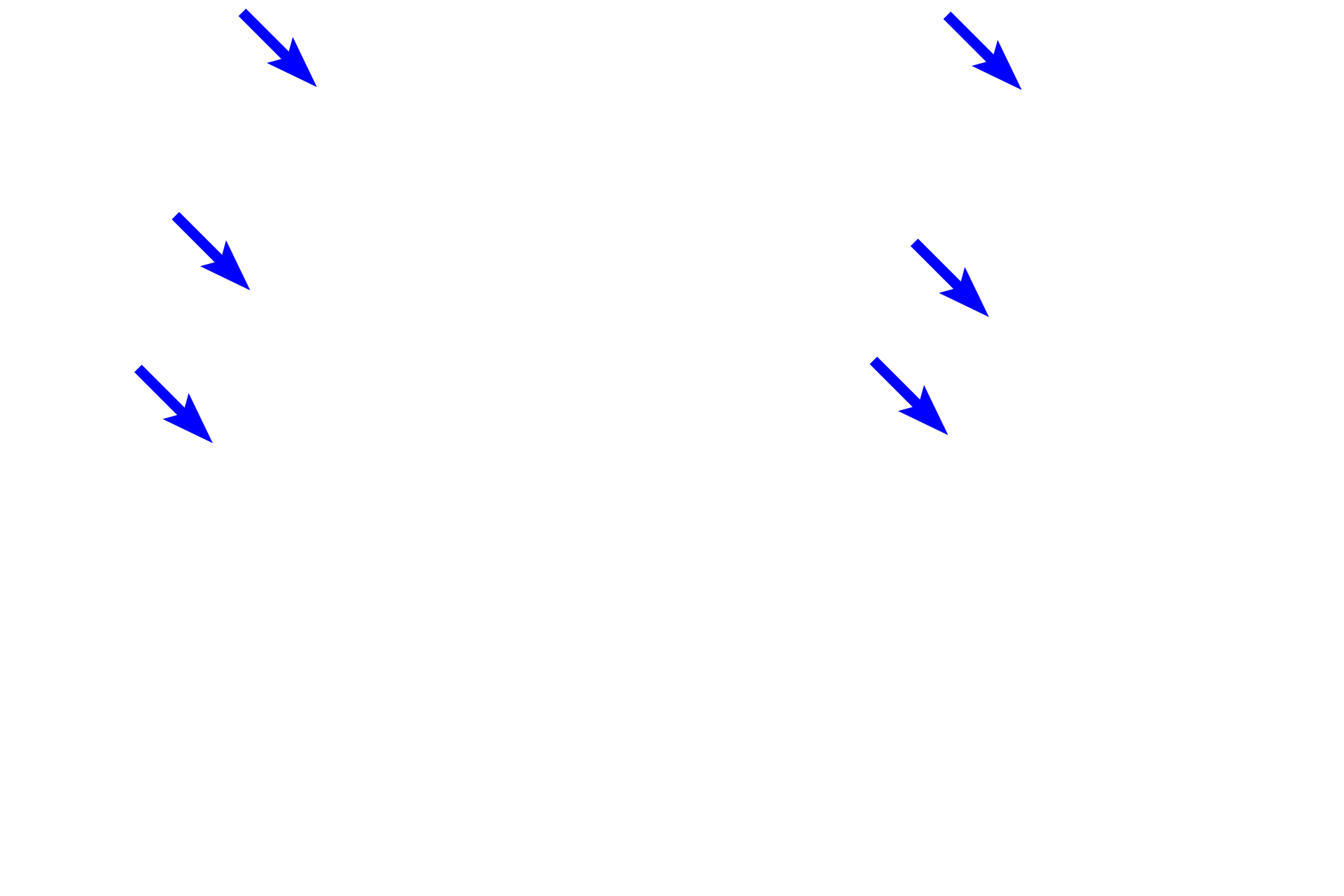  - Dilator pupillae muscle <p>The epithelium covering the posterior surface is a continuation of the non-sensory retina and consists of two layers:  a heavily pigmented epithelium next to the posterior chamber and a less pigmented layer of myoepithelial cells from which radially arranged processes extend into the stroma, forming dilator pupillae muscle.  Contraction of this muscle results in an increase in pupillary diameter.</p>
