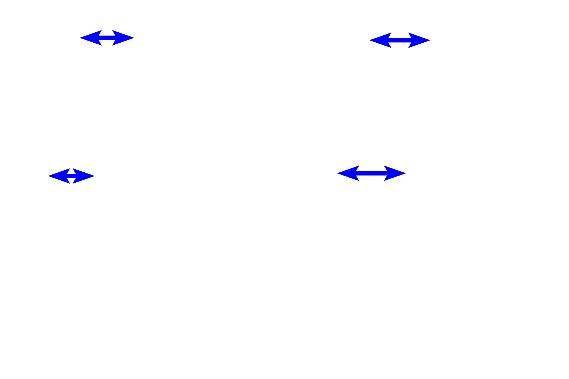  - Stroma > <p>Stroma, formimg the bulk of the iris, is composed of loose connective tissue, containing fibroblasts and melanocytes.  The stroma is highly vascular.  The anterior surface of the iris has numerous grooves and ridges and is not covered by an epithelium.</p>
