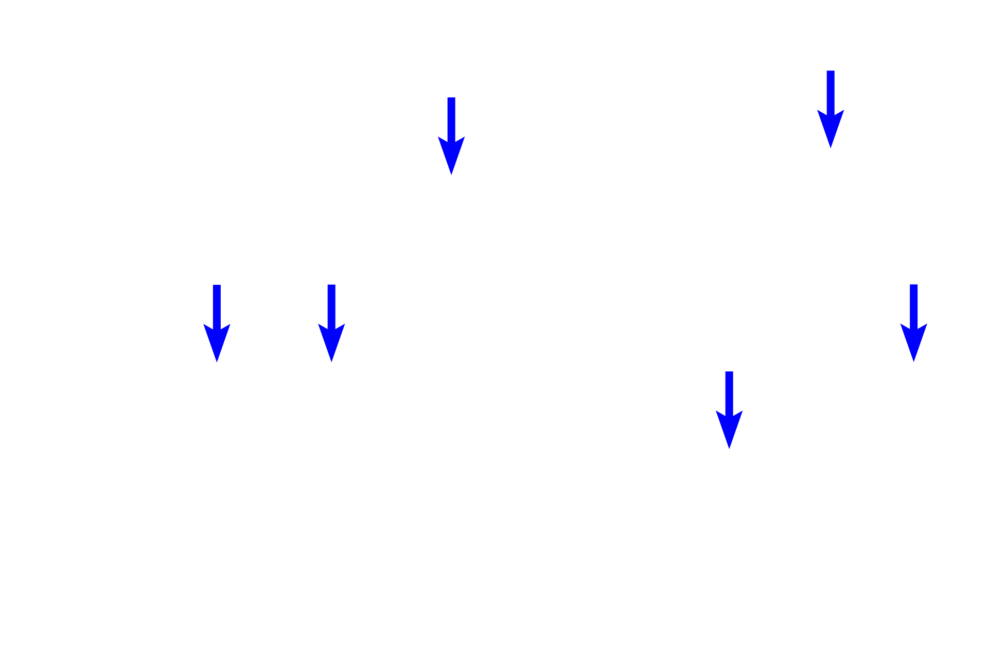  - Lens fibers <p>The bulk of the lens is made primarily of elongated lens fibers that are modified cells of the lens epithelium.  The lens epithelium is present only on the anterior and equatorial regions of the lens and consists of a single layer of cuboidal cells.  The outermost layer of the lens is a capsule, which represents the highly thickened basal lamina of the lens epithelium that lies inside the capsule.</p>
