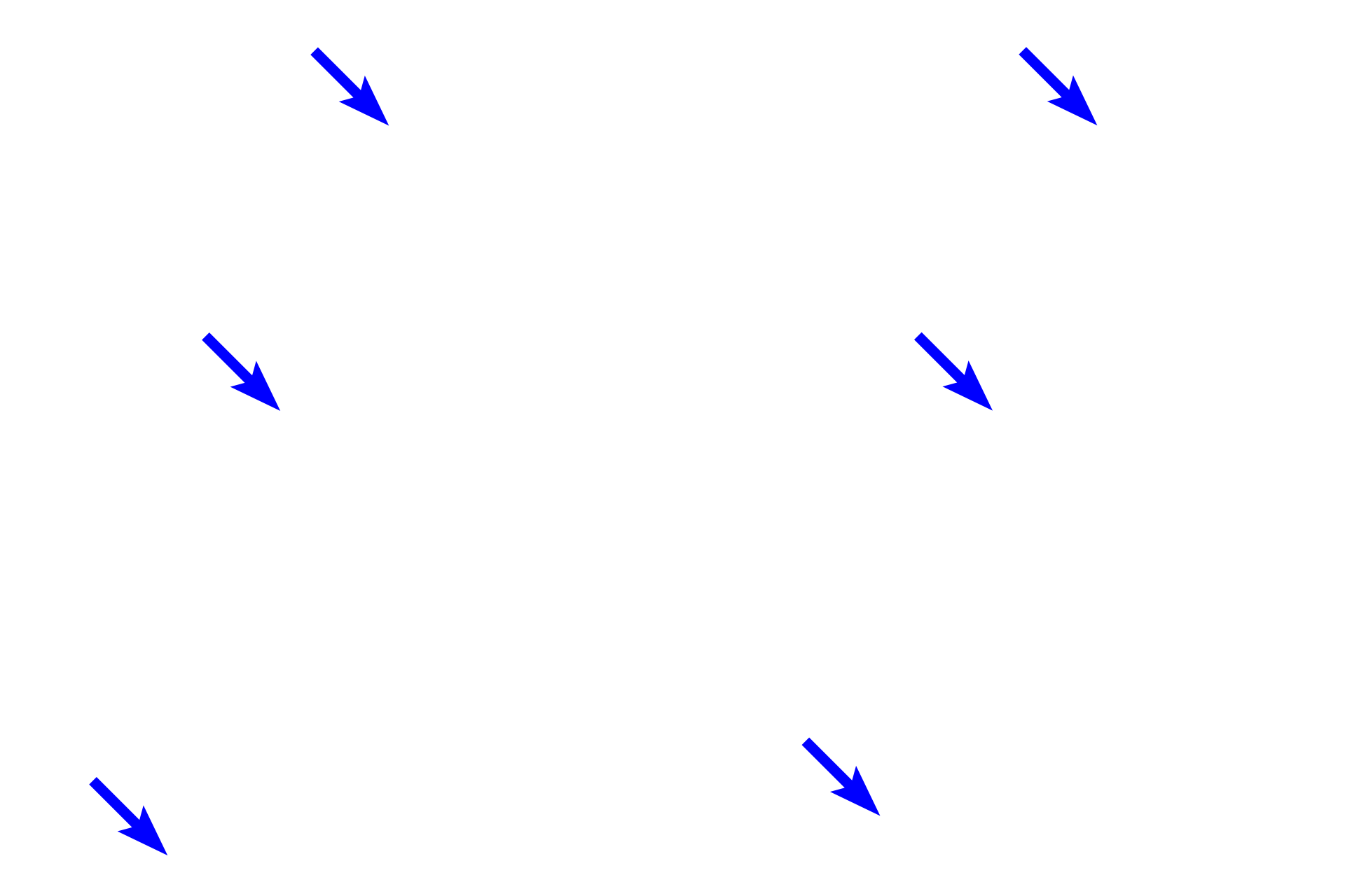  - Lens capsule <p>The bulk of the lens is made primarily of elongated lens fibers that are modified cells of the lens epithelium.  The lens epithelium is present only on the anterior and equatorial regions of the lens and consists of a single layer of cuboidal cells.  The outermost layer of the lens is a capsule, which represents the highly thickened basal lamina of the lens epithelium that lies inside the capsule.</p>
