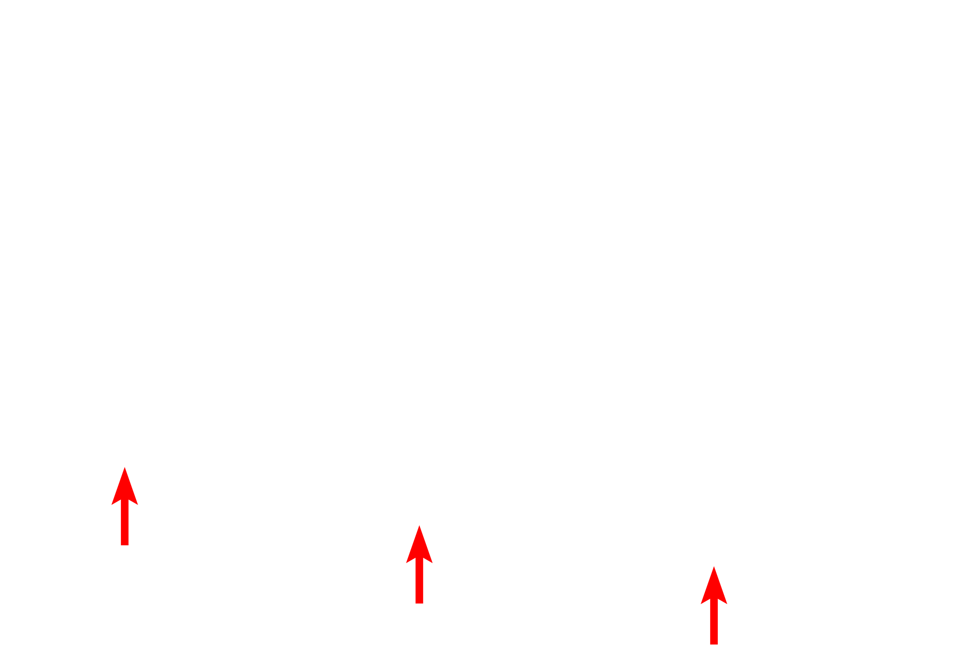 Posterior iris epithelium > <p>The epithelium covering the posterior surface is a continuation of the non-sensory retina and consists of two layers.  The anterior surface of the iris is not lined by an epithelium.</p>
