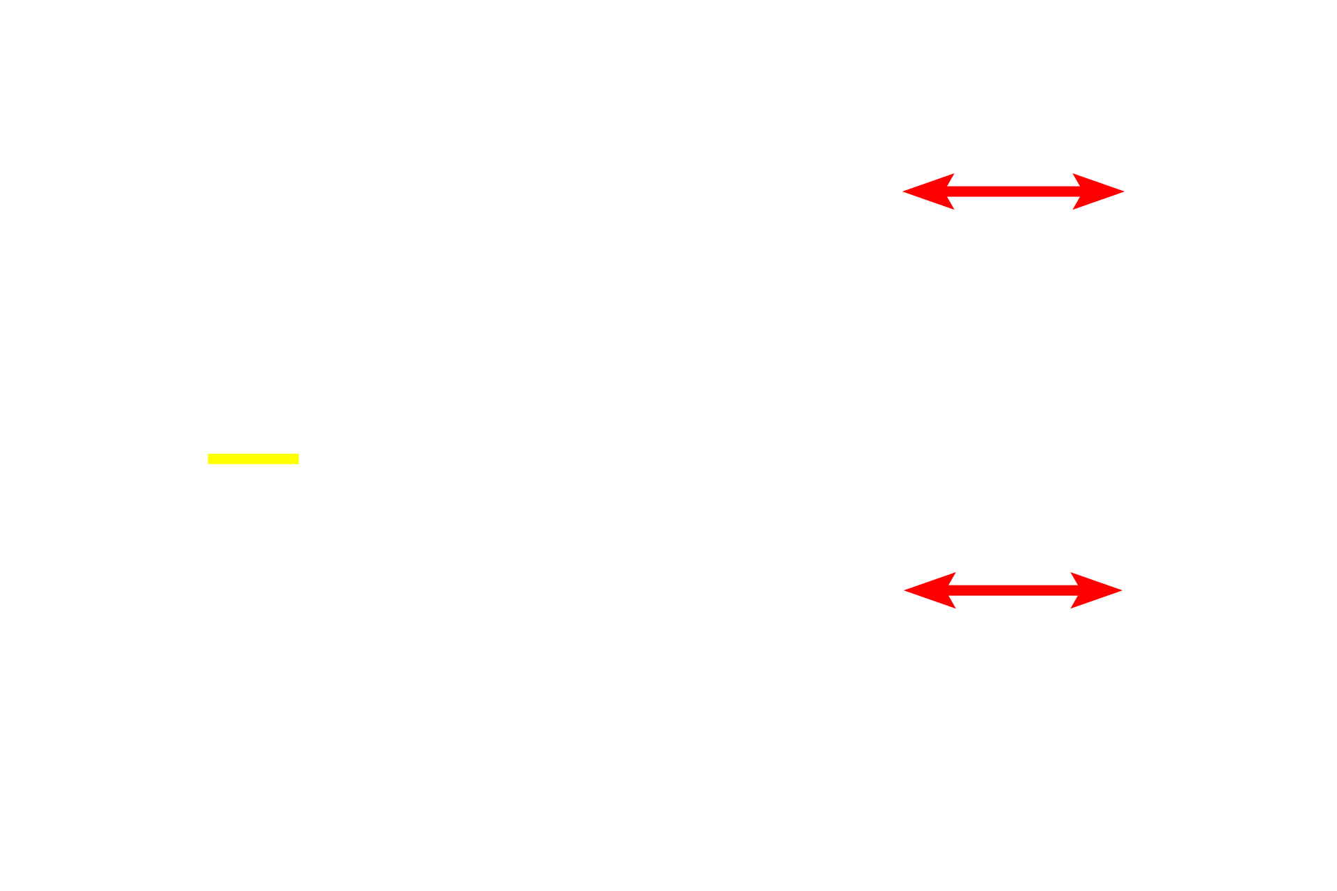 Choroid <p>The choroid, the third part of the vascular tunic or uvea, lies between the sclera and the retina and consists of three layers. From outer to inner, these layers are: a stroma of loose connective tissue with many blood vessels and melanocytes; the choriocapillary layer, a capillary layer that supplies the retina; and Bruch’s membrane that is shared with the retina. 100x, 400x</p>
