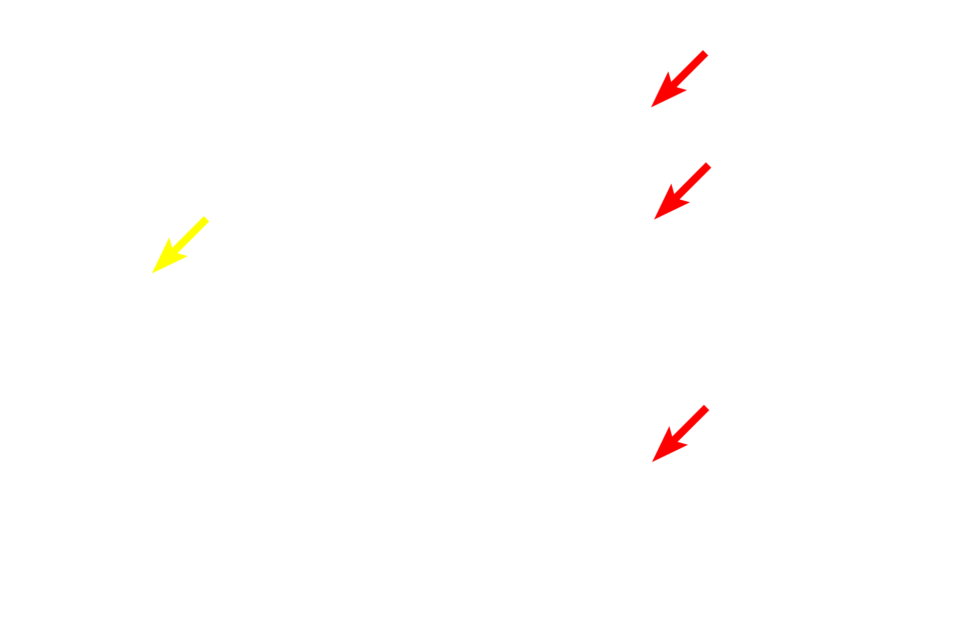  - Bruch's membrane > <p>Bruch’s membrane forms the interface between the choroid and the retina and insures proximity of a vascular supply to the pigment epithelium of the retina. From inner to outer, Bruch’s membrane consists of the basal lamina of the pigment epithelium of the retina, a layer of collagenous and elastic fibers, and the basal lamina of the choriocapillary endothelial cells.</p>
