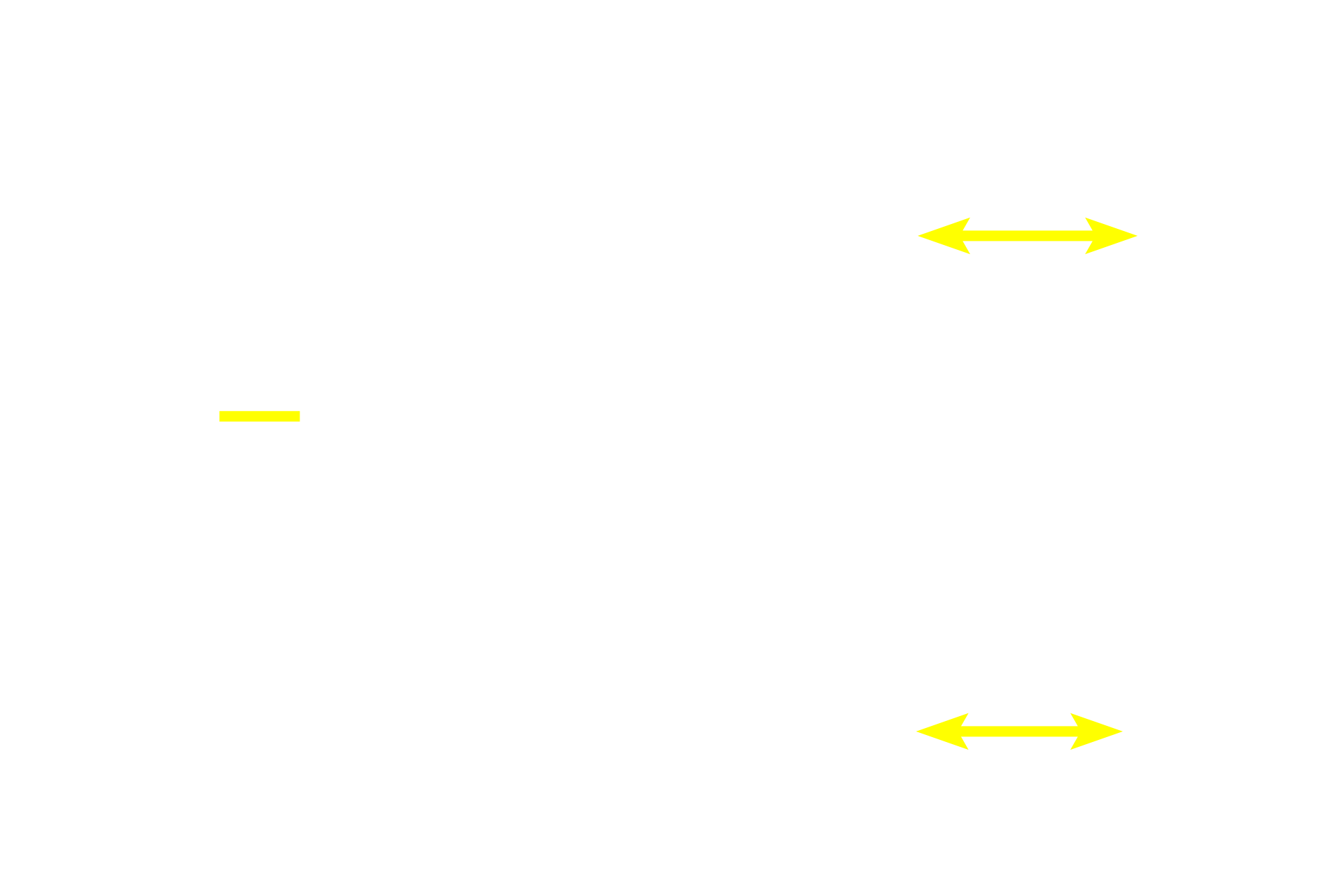  - Choroidal stroma > <p>The choroidal stroma consists of a loose connective tissue containing large melanocytes and vessels of varying sizes.</p>
