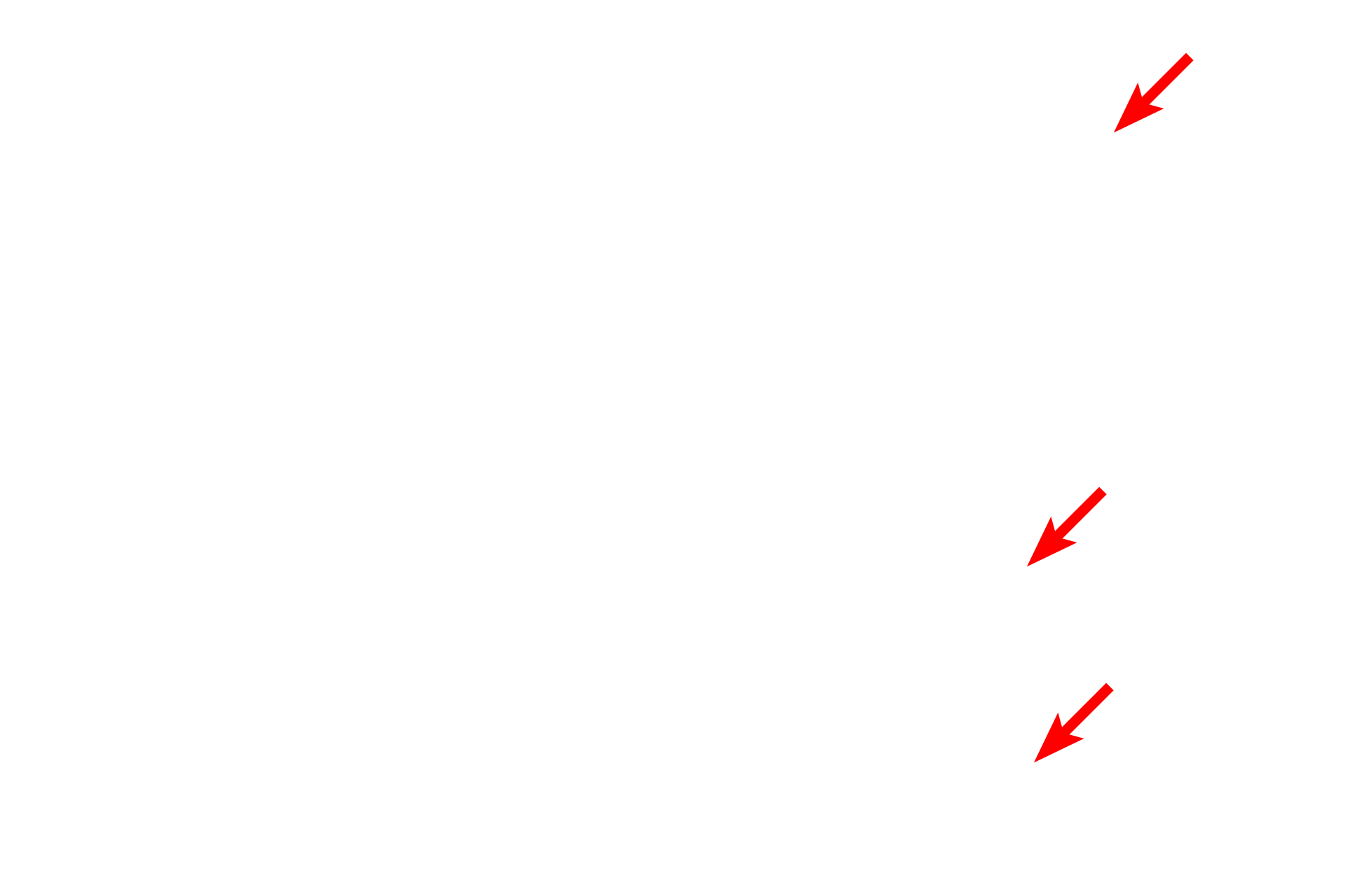  -- Melanocytes <p>The choroidal stroma consists of a loose connective tissue containing large melanocytes and vessels of varying sizes.”</p>
