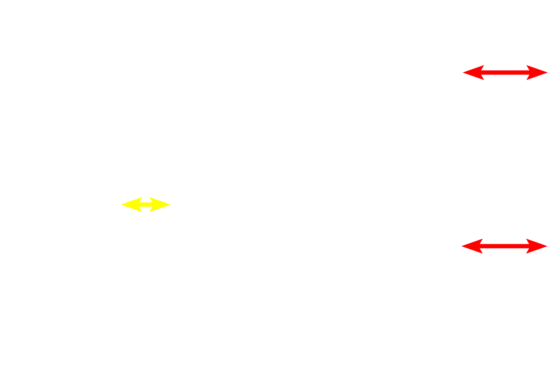 Sclera  <p>The choroid, the third part of the vascular tunic or uvea, lies between the sclera and the retina and consists of three layers. From outer to inner, these layers are: a stroma of loose connective tissue with many blood vessels and melanocytes; the choriocapillary layer, a capillary layer that supplies the retina; and Bruch’s membrane that is shared with the retina. 100x, 400x</p>
