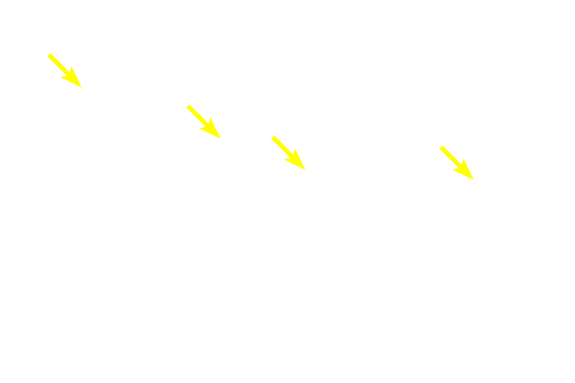  -- Melanocytes with melanosomes <p>This higher magnification image shows the cellular details of the choroid and its interface with the retina.  1000x</p>
