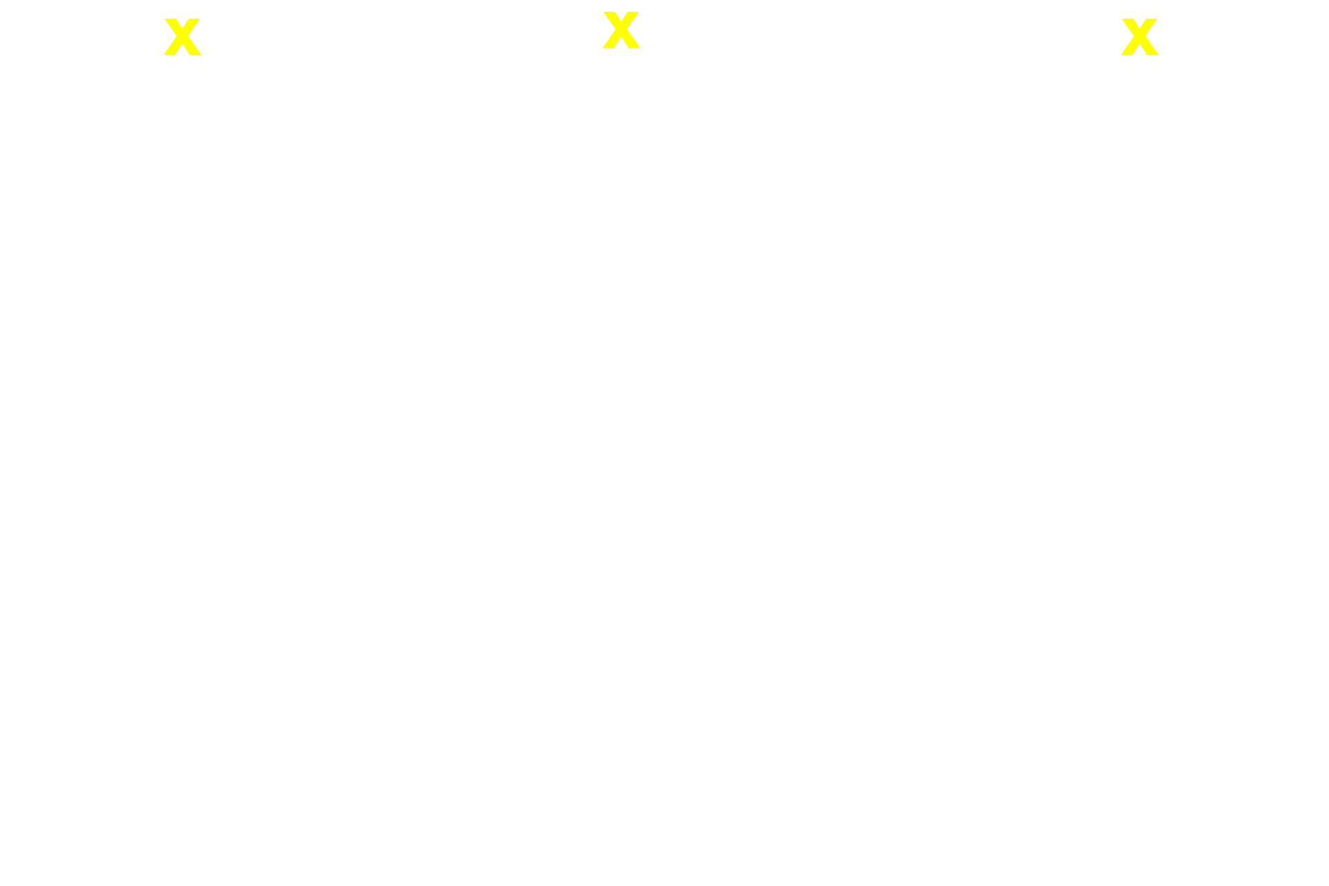 Sclera <p>This higher magnification image shows the cellular details of the choroid and its interface with the retina.  1000x</p>

