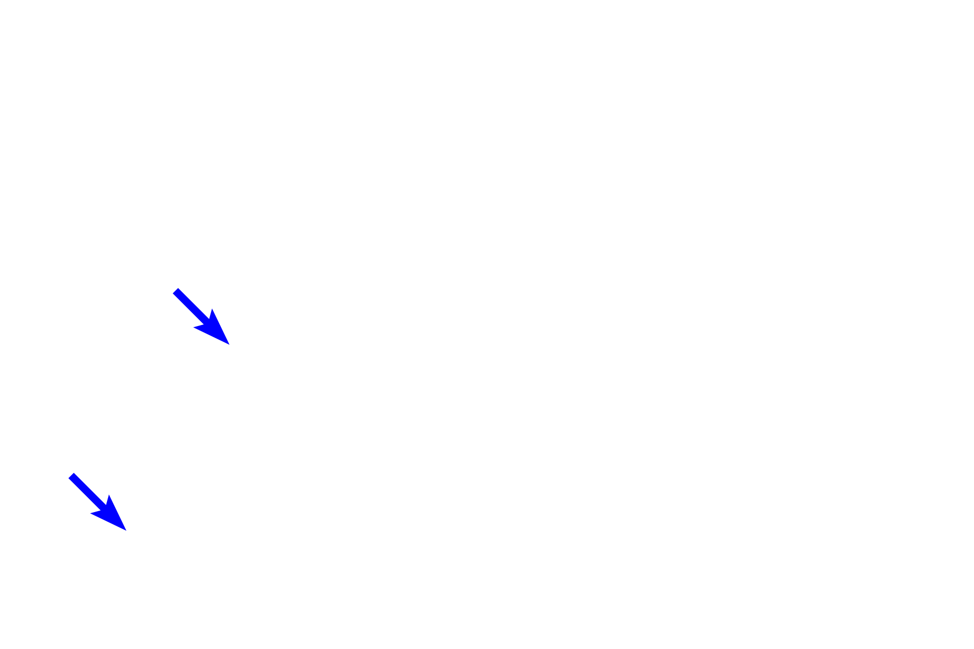 Cornea > <p>The cornea, the major refractile part of the eye, is part of the outer tunic along with the sclera.  The transparency of the cornea results from the regular arrangement of collagen fibers in its stroma.  The cornea is surfaced by the corneal epithelium that transitions to the bulbar conjunctiva, which covers the sclera.</p>
