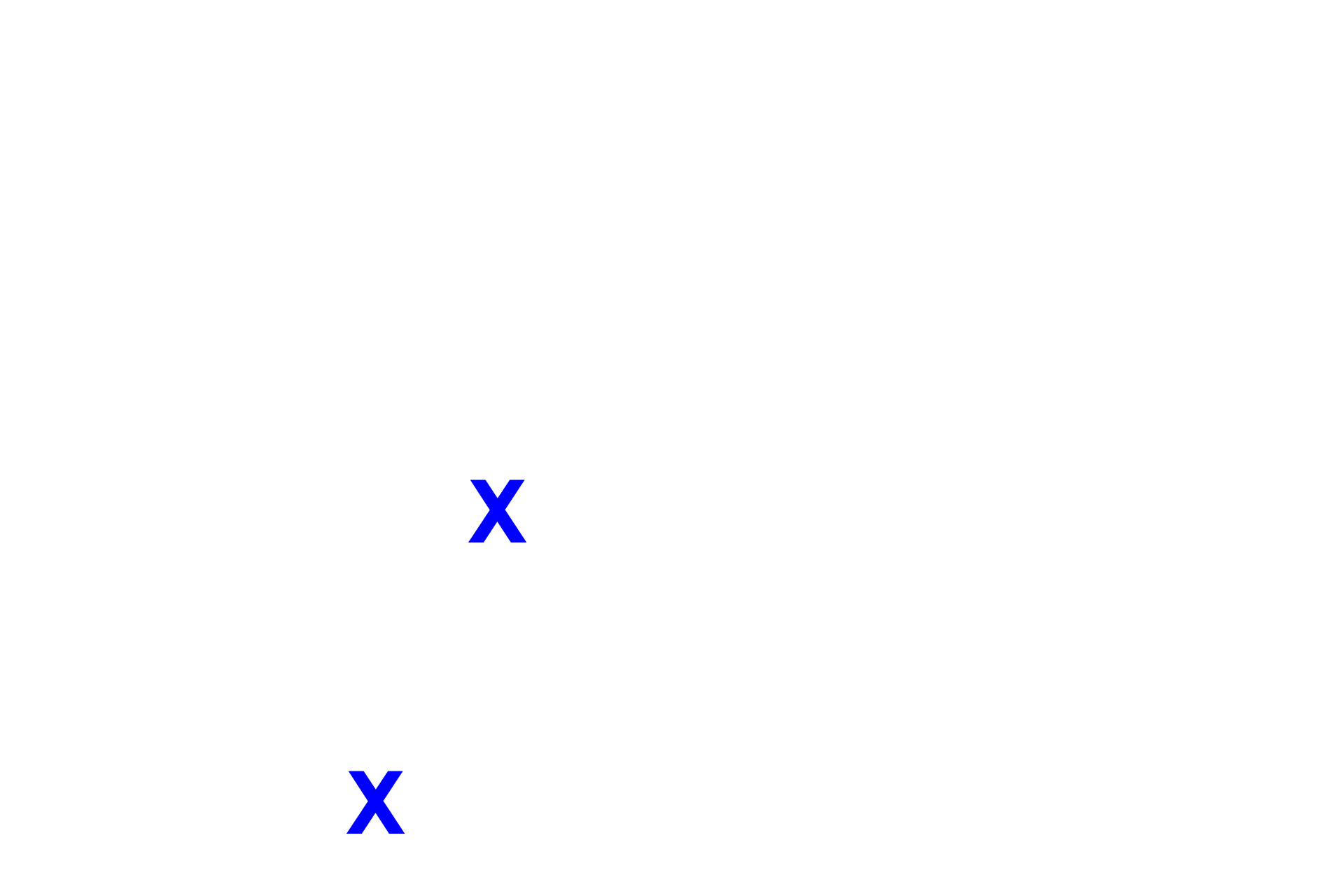 Anterior chamber <p>The posterior chamber is filled with aqueous humor produced by the ciliary epithelium.  Aqueous humor flows from the posterior chamber, between the iris and the lens and into the anterior chamber.</p>
