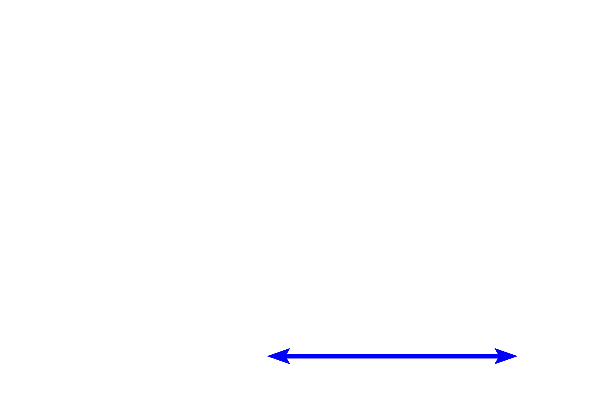 Lens > <p>The lens is a transparent, biconvex disc suspended behind the iris by suspensory zonule fibers attached to the ciliary body.  Due to its crystalline structure, the lens often shows significant artifactual damage.</p>
