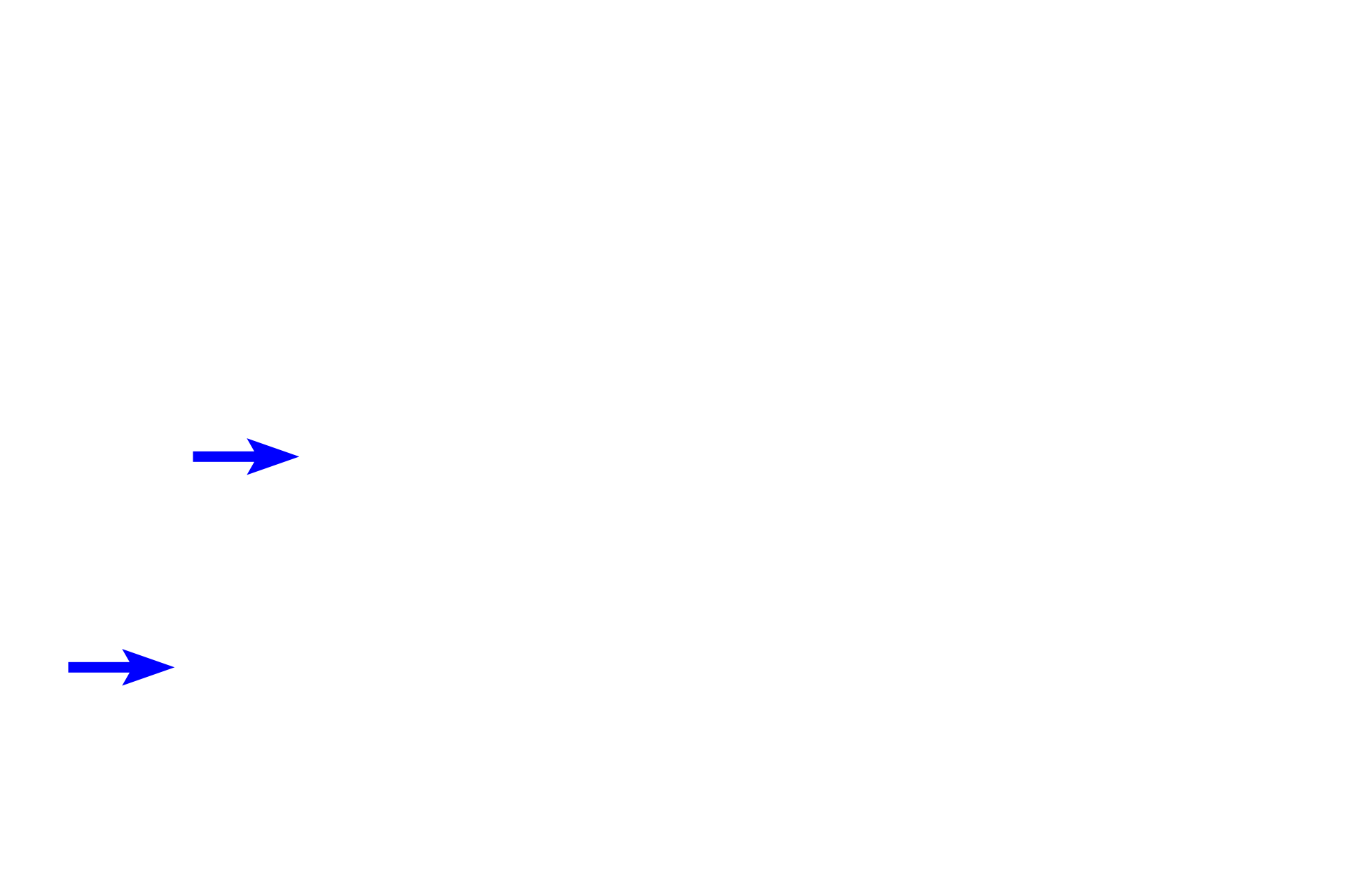  - Corneal epithelium <p>The cornea, the major refractile part of the eye, is part of the outer tunic along with the sclera.  The transparency of the cornea results from the regular arrangement of collagen fibers in its stroma.  The cornea is surfaced by the corneal epithelium that transitions to the bulbar conjunctiva which covers the sclera.</p>
