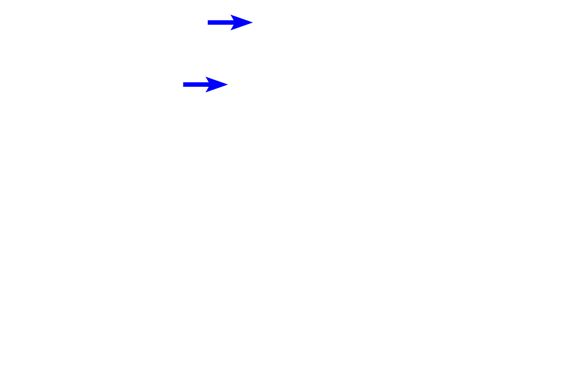 Bulbar conjunctiva <p>The cornea, the major refractile part of the eye, is part of the outer tunic along with the sclera.  The transparency of the cornea results from the regular arrangement of collagen fibers in its stroma.  The cornea is surfaced by the corneal epithelium that transitions to the bulbar conjunctiva which covers the sclera.</p>
