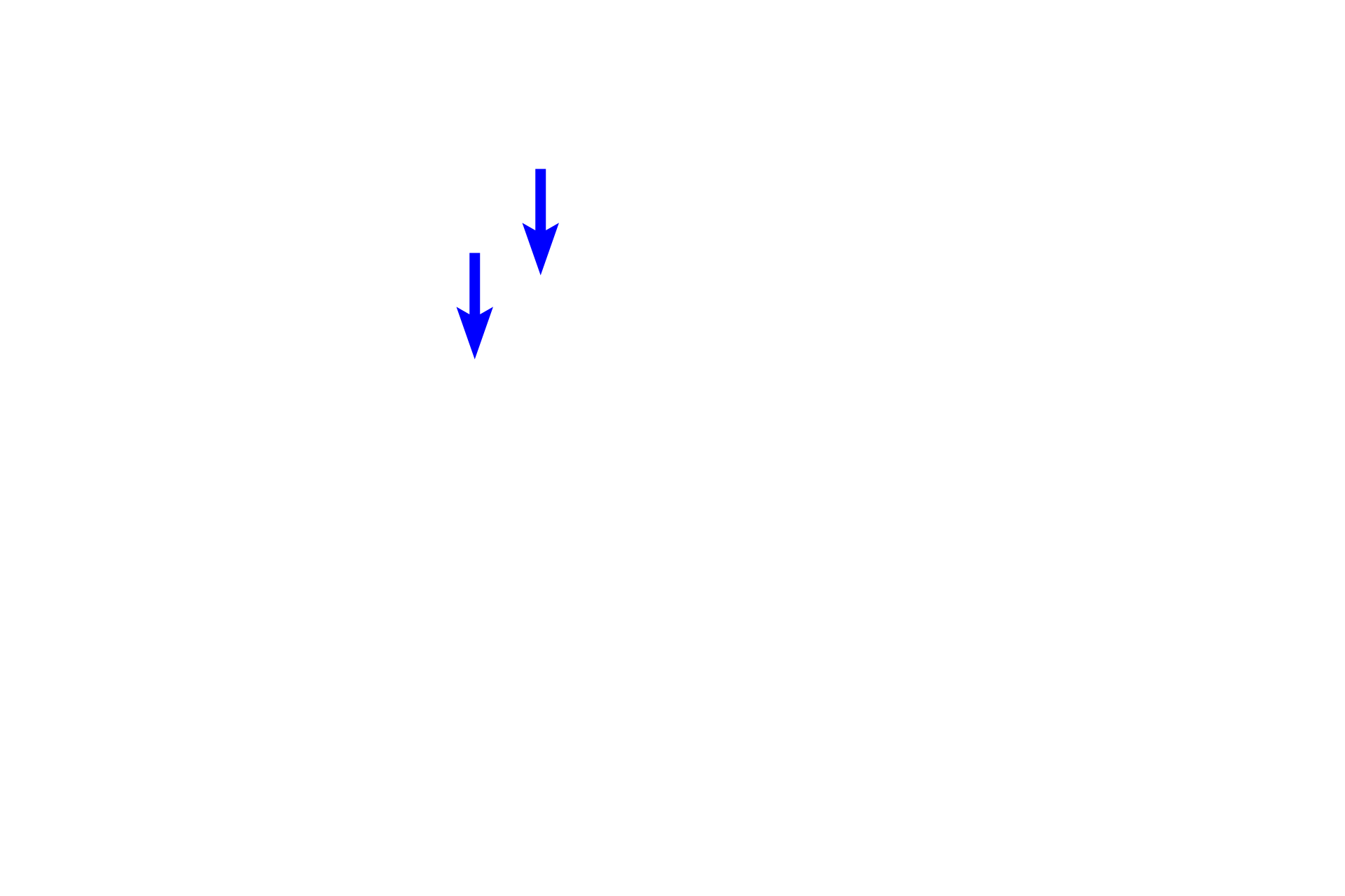 Canal of Schlemm > <p>The canal of Schlemm is a ring-shaped vascular sinus that is located at the junction of the cornea and sclera. It is lined by endothelium and receives the aqueous humor from the trabecular meshwork. From the canal of Schlemm, fluid passes into veins of the sclera. This flow is facilitated by contraction of the ciliary muscle. Improper drainage of the aqueous humor results in increased intraocular pressure, a condition known as glaucoma, and can result in blindness.</p>
