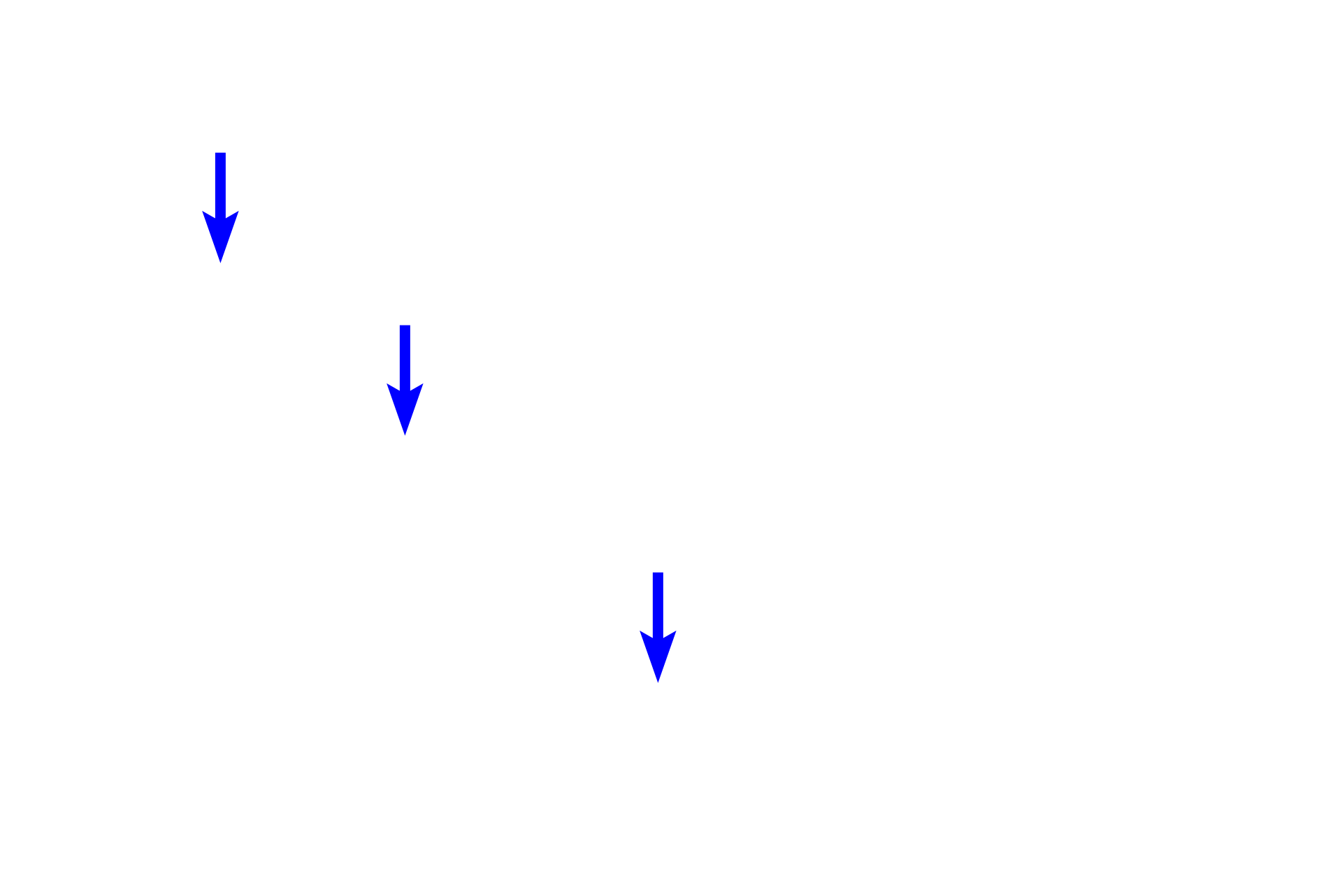  - Subchoroid lamina (lamina fusca) > <p>The thin subchoroid lamina lies between the substania propria and the choroid.  It consists of loose connective tissue as well as scattered melanocytes.</p>
