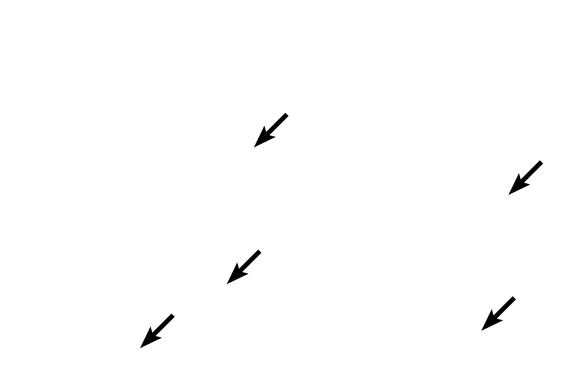 Extraocular muscle <p>Extrinsic ocular muscles consist of three three pairs of antagonistic muscles that control movement of the eye.  They originate from the posterior region of the orbit and insert on the sclera.  They A seventh muscle, the levator palpebrae, elevates the upper eyelid.  All extraocular muscles are composed of skeletal muscle fibers that are innervated by cranial nerves III, IV and VI. </p>
