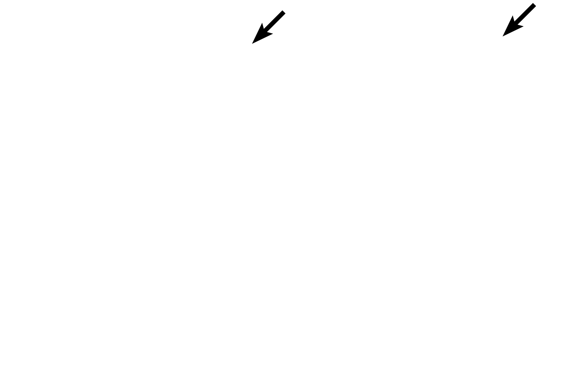 Sclera <p>Extrinsic ocular muscles consist of three three pairs of antagonistic muscles that control movement of the eye.  They originate from the posterior region of the orbit and insert on the sclera.  They A seventh muscle, the levator palpebrae, elevates the upper eyelid.  All extraocular muscles are composed of skeletal muscle fibers that are innervated by cranial nerves III, IV and VI. </p>
