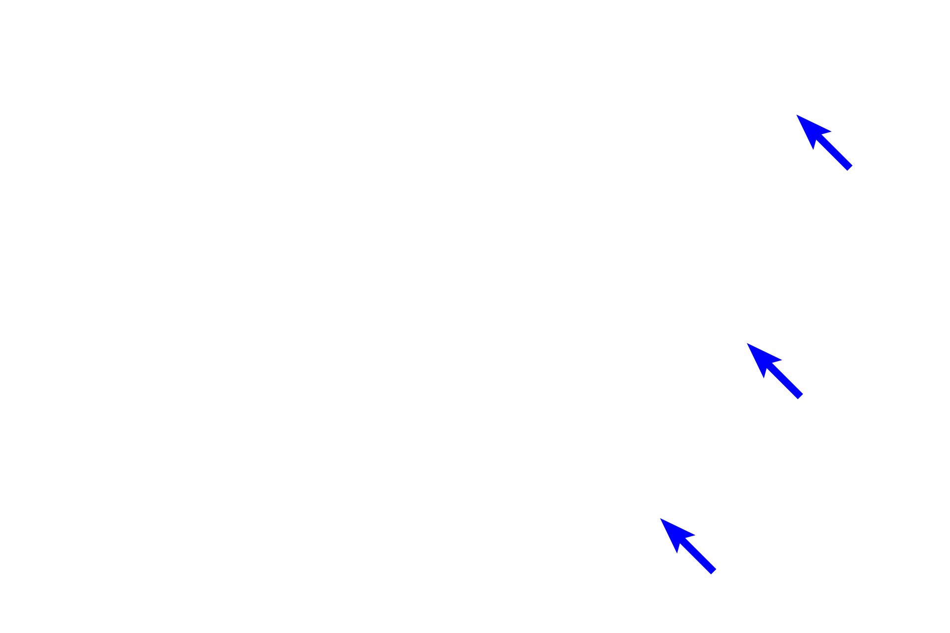 Choroid <p>These images show extrinsic ocular muscles, three three pairs of antagonists muscles that control movement of the eye.  They originate from the posterior region of the orbit and insert on the sclera.    They A seventh muscle, the levator palpebrae, elevates the upper eyelid.  All extraocular muscles are composed of skeletal muscle fibers that are innervated by cranial nerves III, IV and VI.</p>
