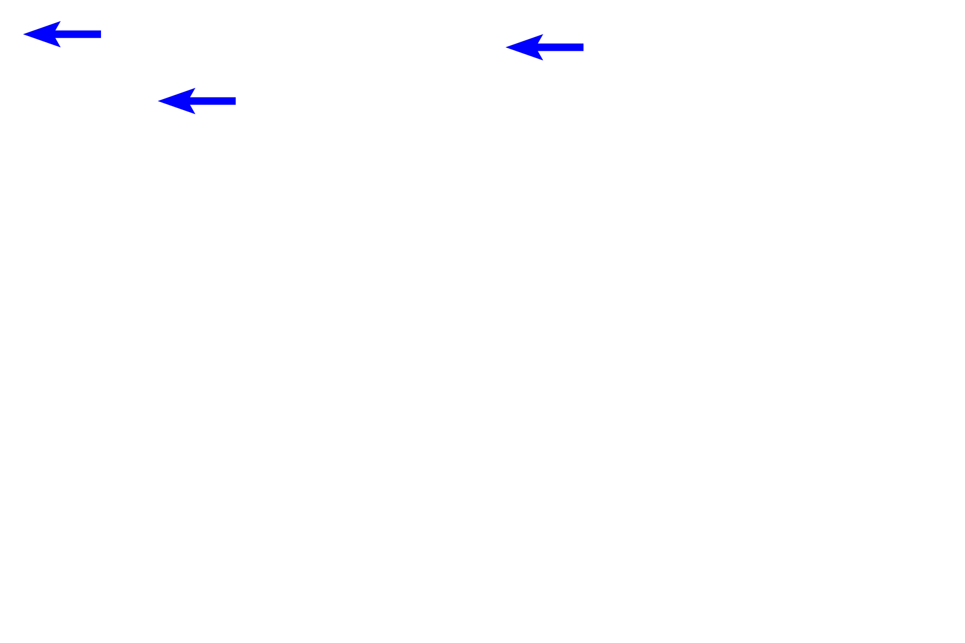 Zonule fibers <p>This image of the equatorial region of the lens shows the lens epithelium lying just beneath the capsule. These cells proliferate, generating lens fibers.  This process allows for growth of the lens and continues at a slow, but decreasing rate throughout adult life. The equatorial region also serves as the site of attachment for the zonule fibers extending from the ciliary body.</p>
