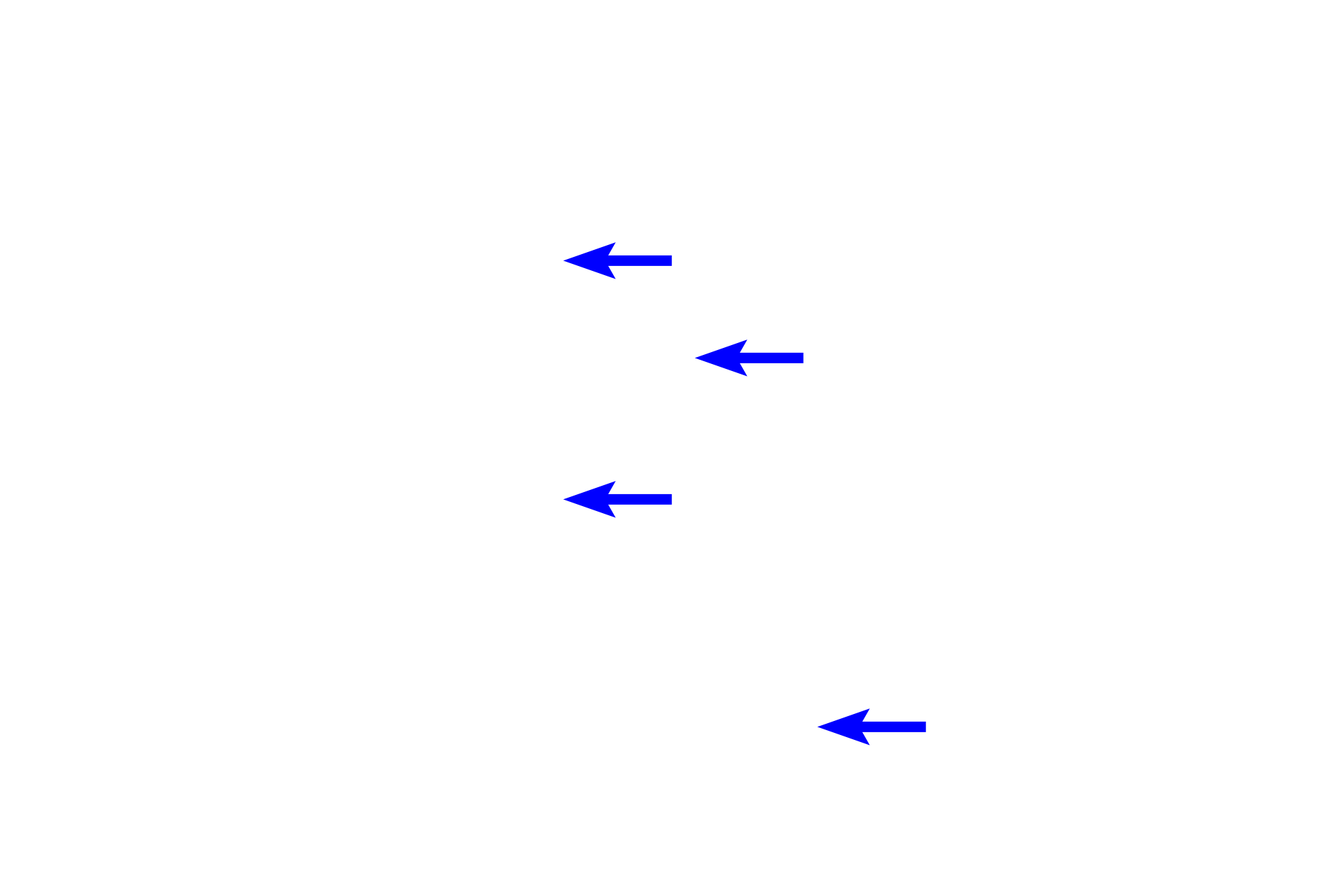 Lens fibers > <p>Once generated, lens fibers elongate and flatten in an axis parallel to the light path.  They gradually lose their nuclei and other organelles as they descend into the lens.  During this process, their cytoplasm becomes filled with a group of proteins called crystallins that provide transparency and a high refractive index.  Mature lens fibers are extremely long, typically 7–10 mm and are densely packed together forming a perfectly transparent tissue.</p>

