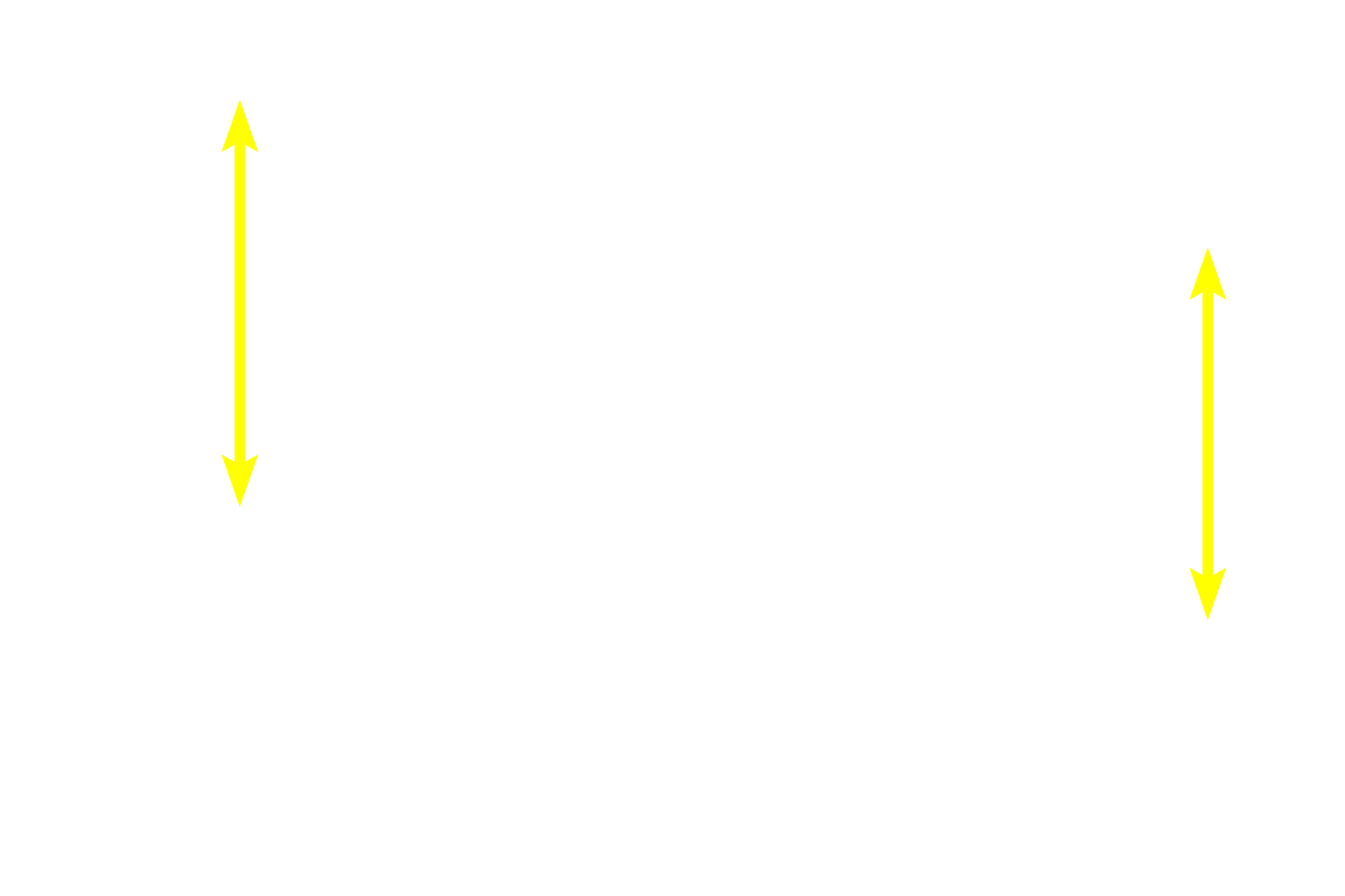 Retina <p>The fovea is a small depression in the retina that lies at the center of a larger, oval-shaped area called the macula lutea.  The fovea is on the visual axis of the eye and, thus, provides the area of highest visual acuity or resolution in the retina.  200x</p>
