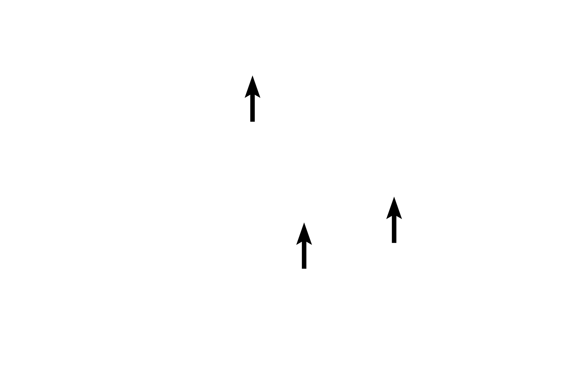 Retinal blood vessels > <p>The retinal artery branches immediately into upper and lower branches, each of which divides again into nasal and temporal branches.   Note that retinal vessels are absent in the fovea which receives nutrients from the choriocapillary layer.</p>
