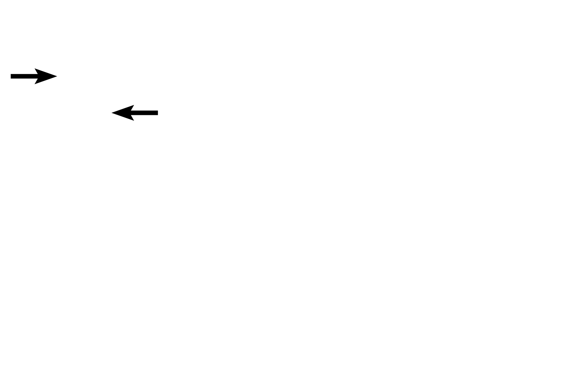  - Ciliary processes <p>The ciliary body consists of two regions, the pars plicata which supports the ciliary processes and the pars plana which is the flat region between the pars plicata and the ora serrata.  The non-sensory retina covers both regions and extends to line the posterior surface of the iris.</p>
