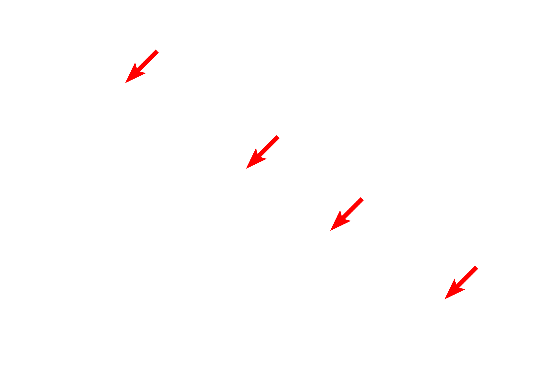 - Pigment epithelium <p>This image shows the ora serrata at higher magnification.  Note how the multilayered, sensory retina (to the right) collapses into a single layer of cuboidal/columnar epithelium over the ciliary body.  The pigment epithelium of the retina continues forward and underlies the layer derived from the sensory retina.</p>
